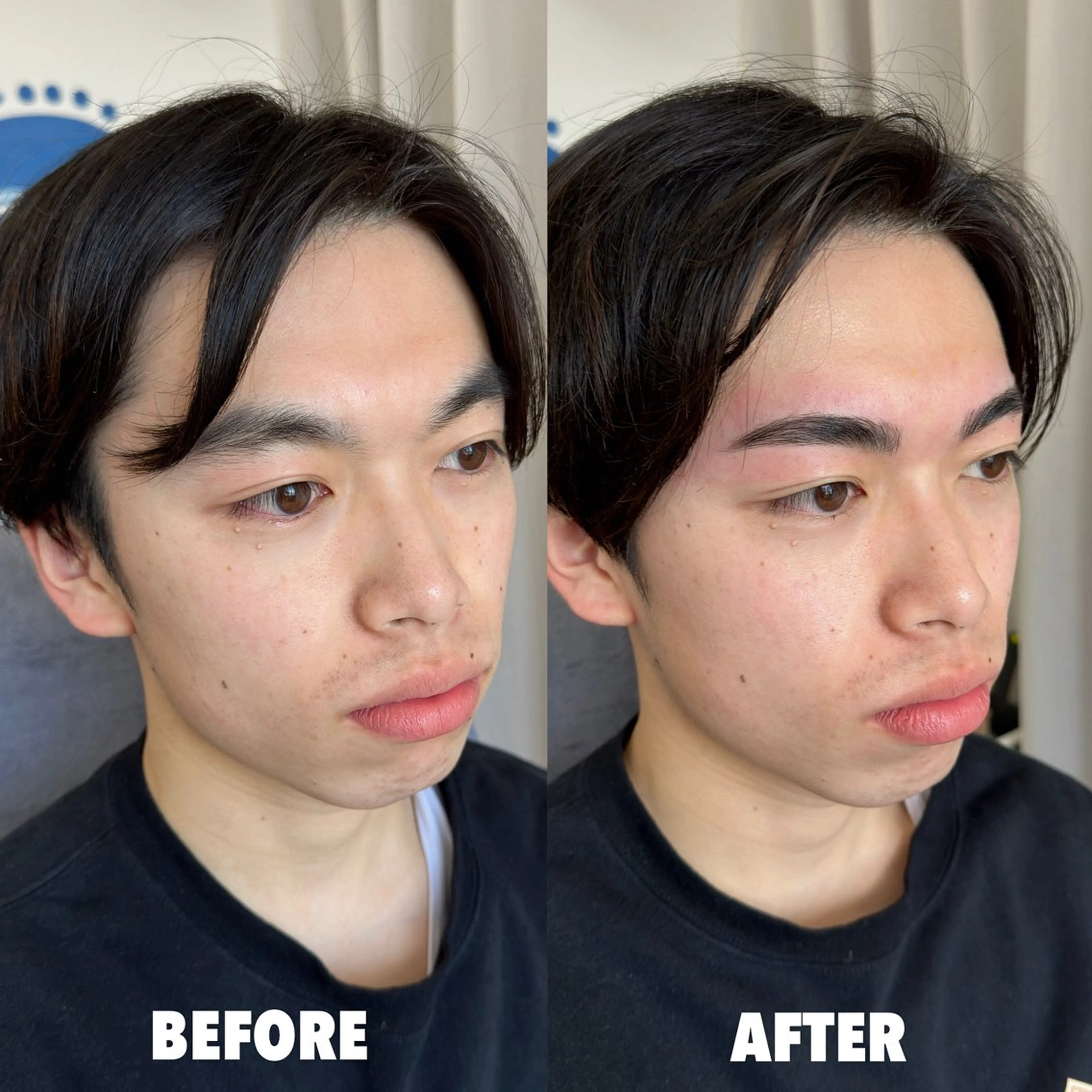 メンズ アイブロウ メンズアイブロウ ワックス脱毛 眉カット その他(アイブロウ) サニーヒルズ藤沢 HARUMIの眉毛・アイブロウイメージ