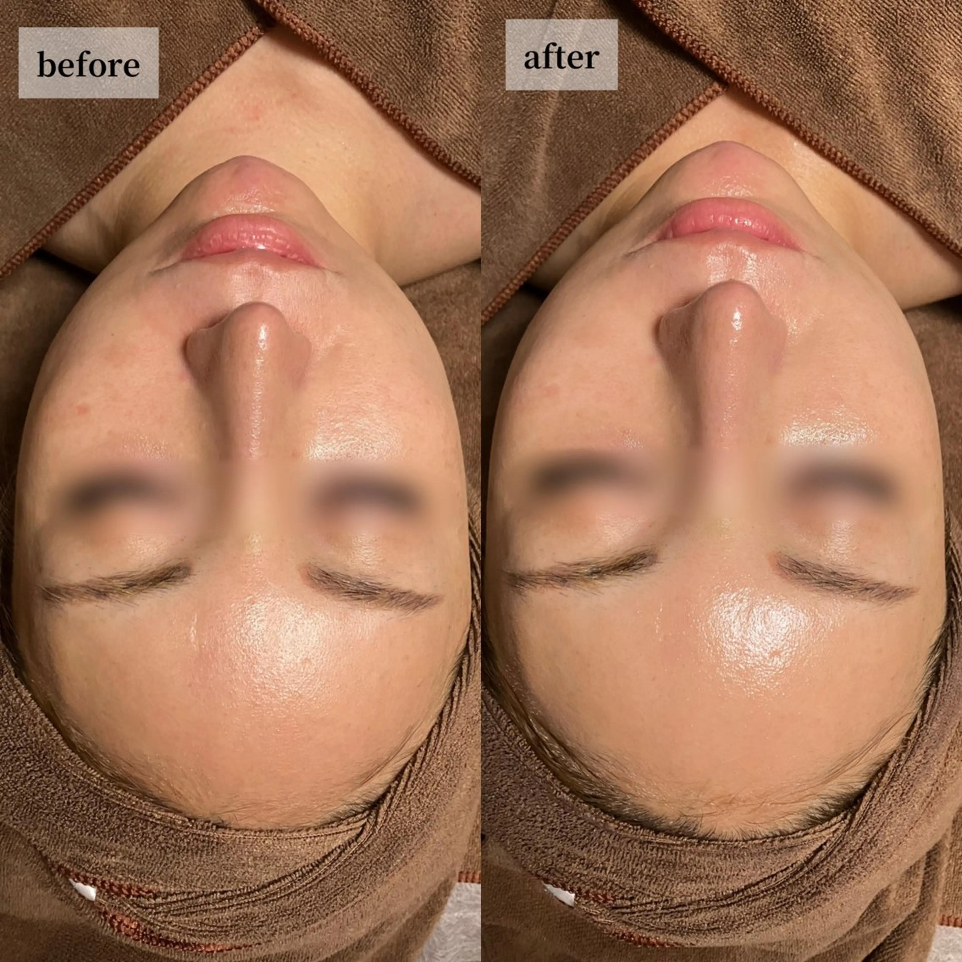 エステ HINANO矢場町店【ヒナノ】所属・脱毛/肌改善🌿 HINANO 村田のエステ・リラクイメージ