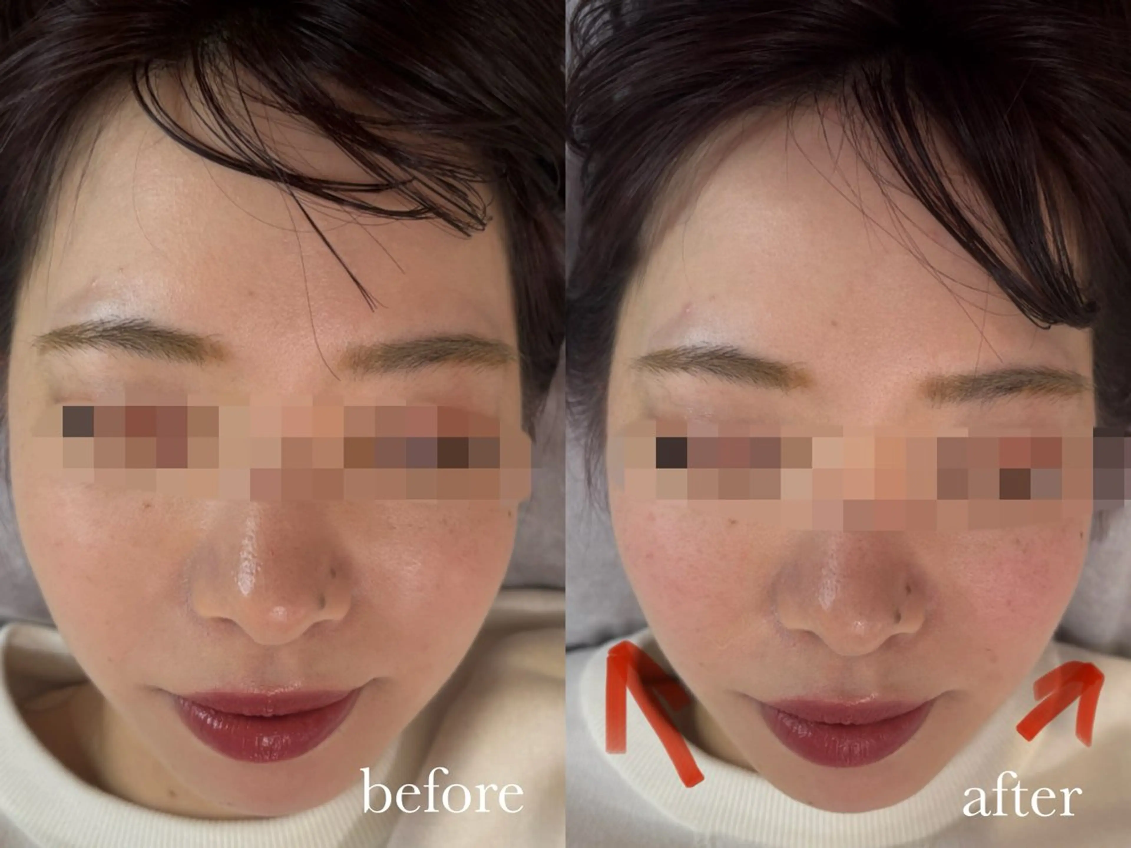 エステ リラク ENNE🦩小顔整体 師🌿 HINAKOのエステ・リラクイメージ