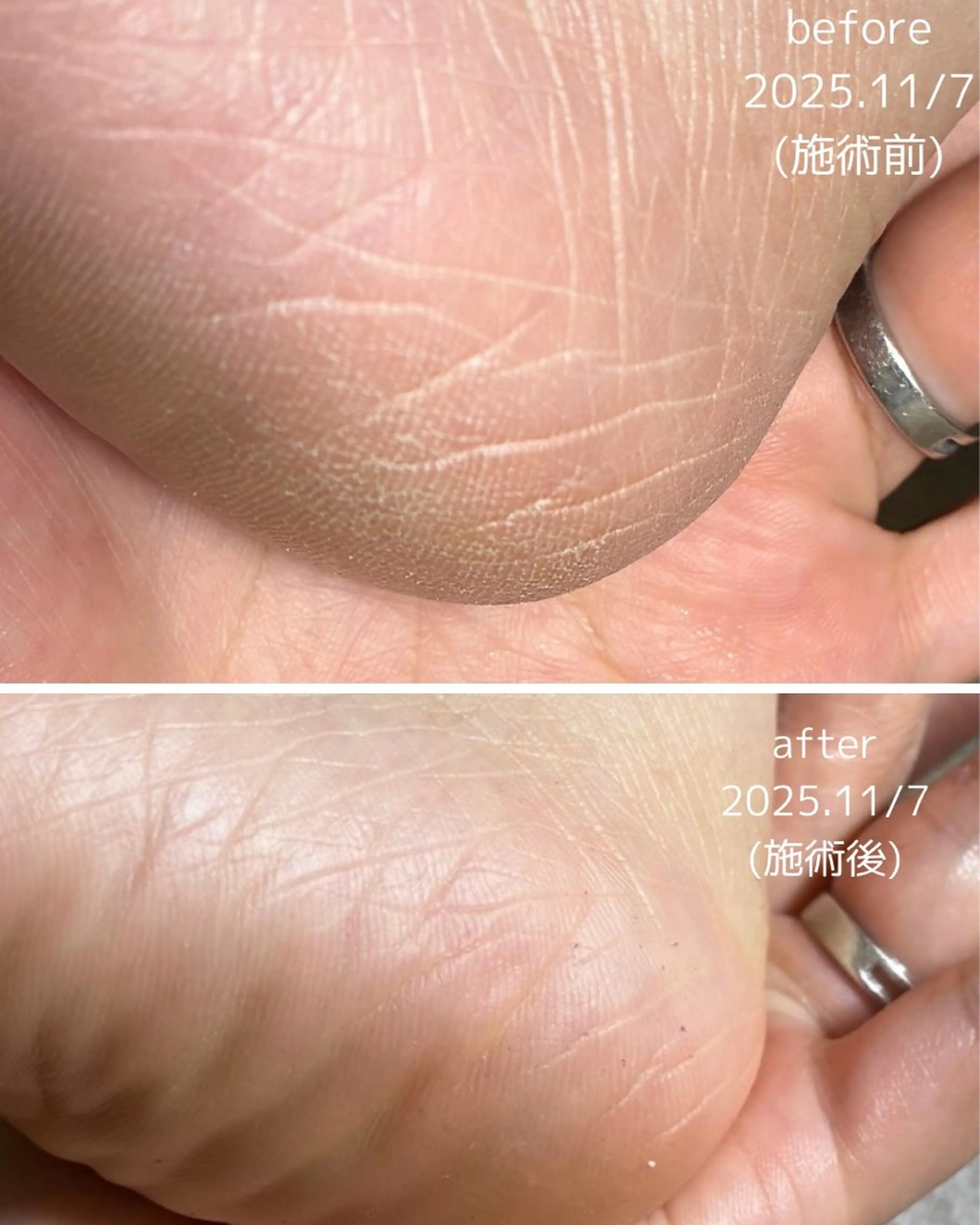 Li.m nail リム ネイルのネイルデザイン