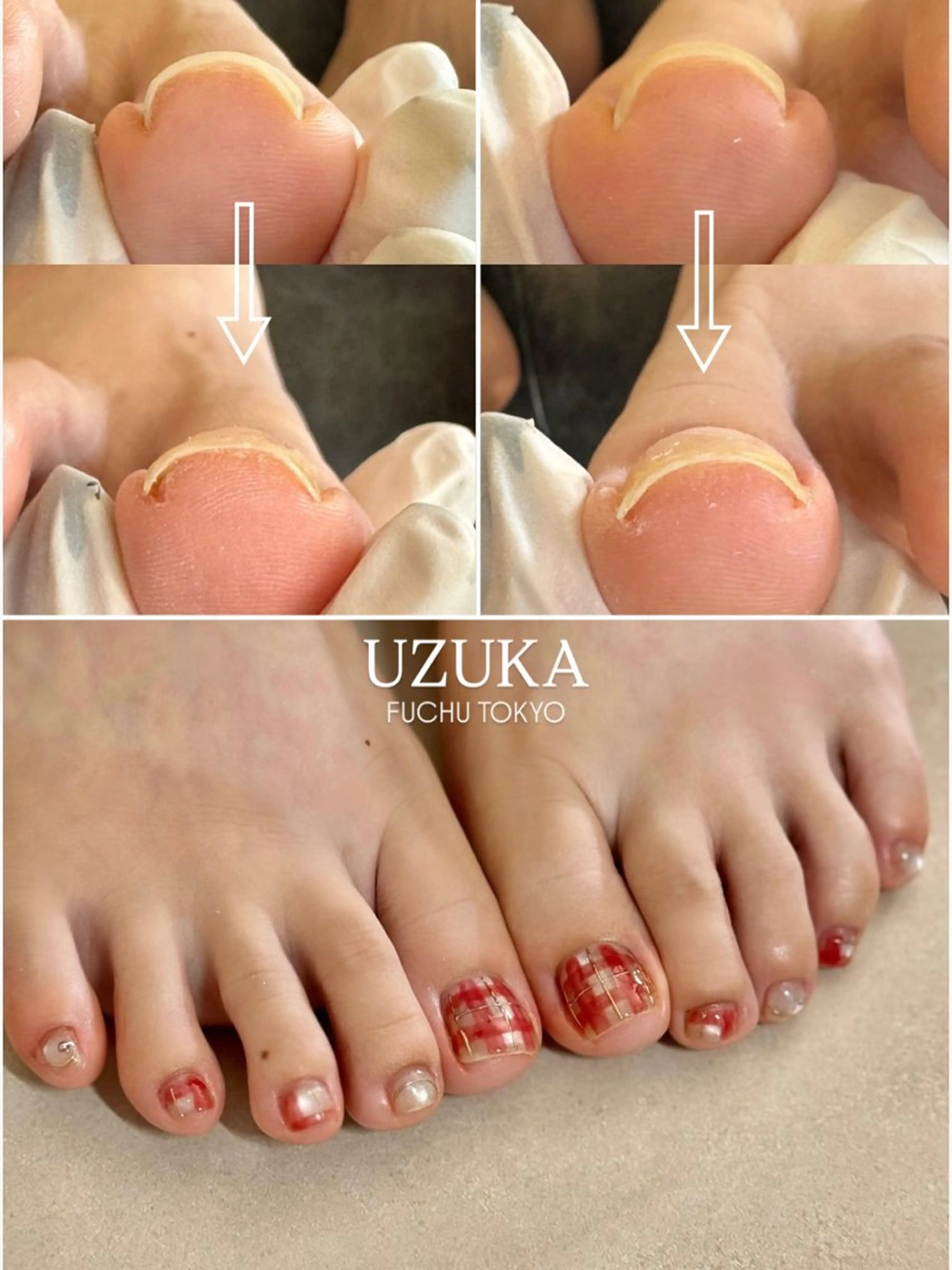 ネイル フットネイル フットネイル 【 enn 】 Uzuka Yukaのネイルデザイン