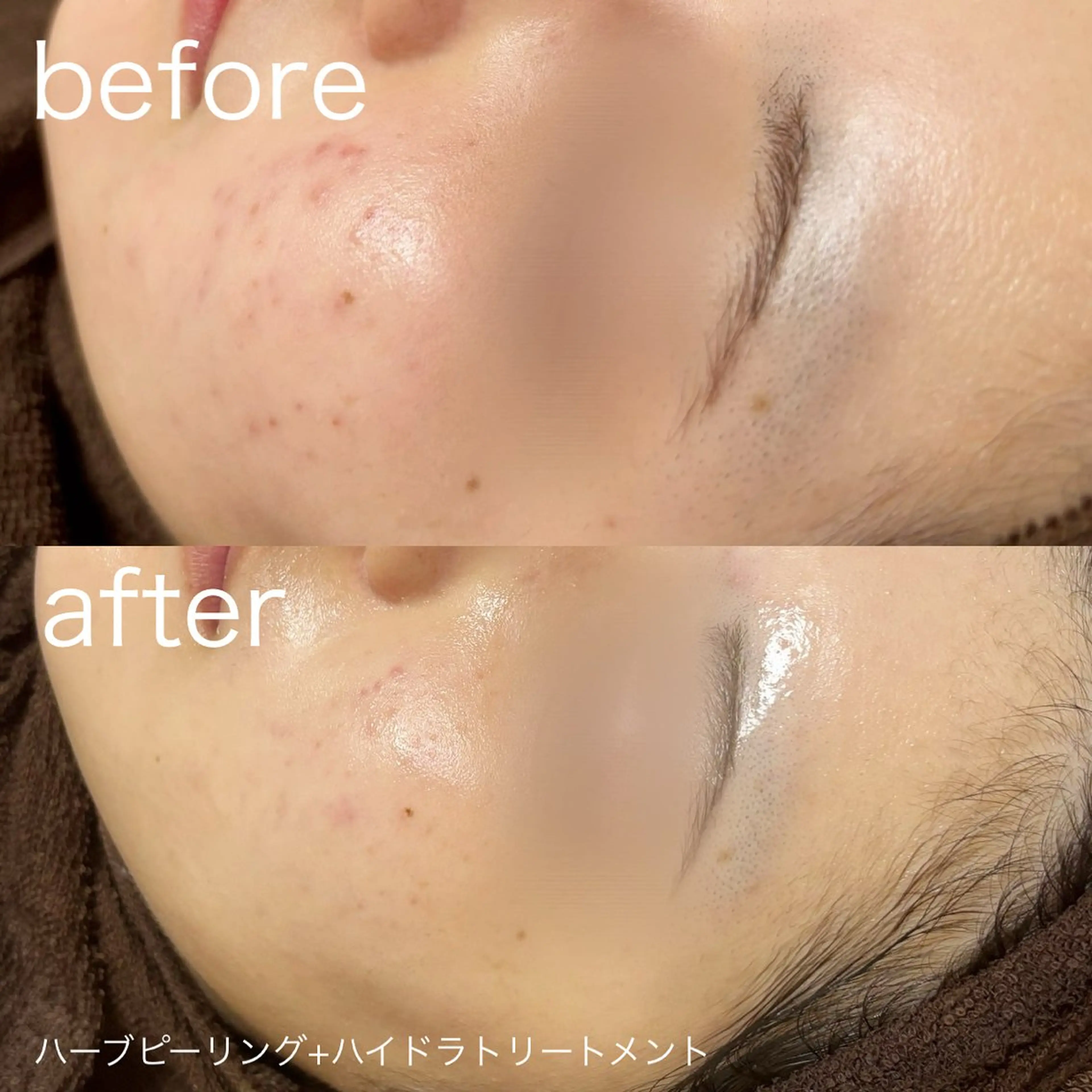 脱毛 lulularico Yu🫧のエステ・リラクイメージ