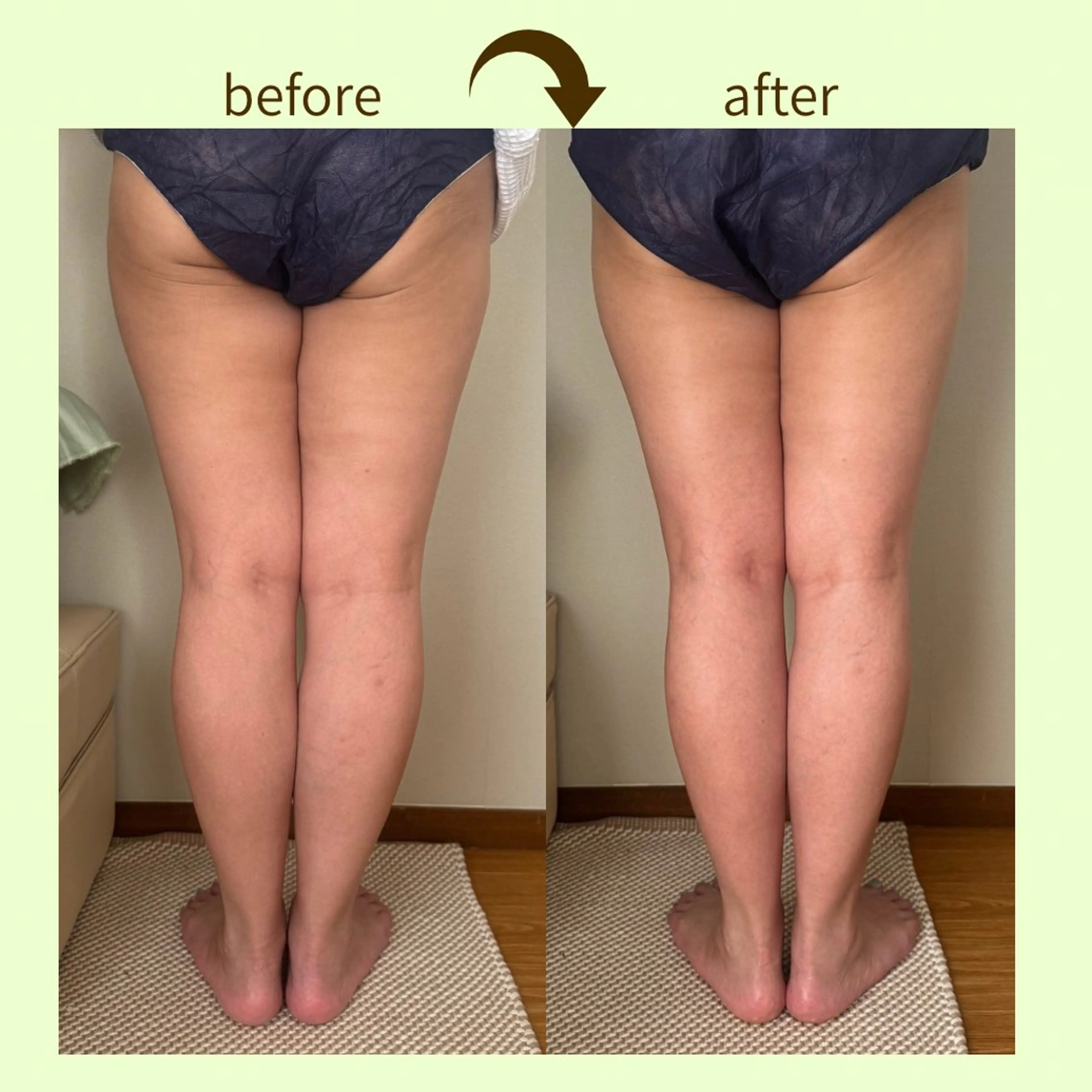 リラクゼーションスパ　ひのき所属・spaHINOKI 【女性専用】のエステ・リラクイメージ