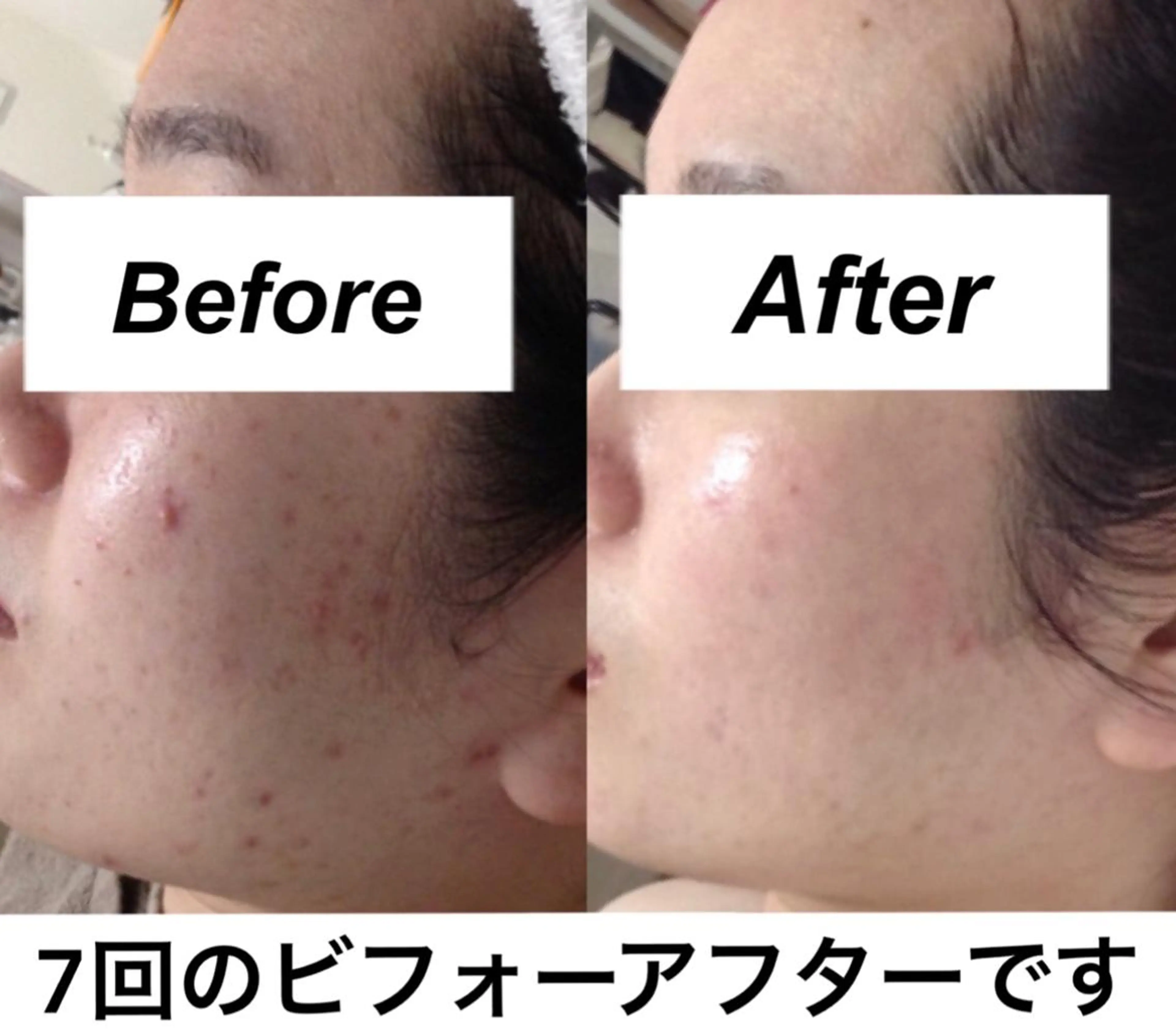 エステ リラク 都度払い肌質改善 &脱毛Blancheのエステ・リラクイメージ