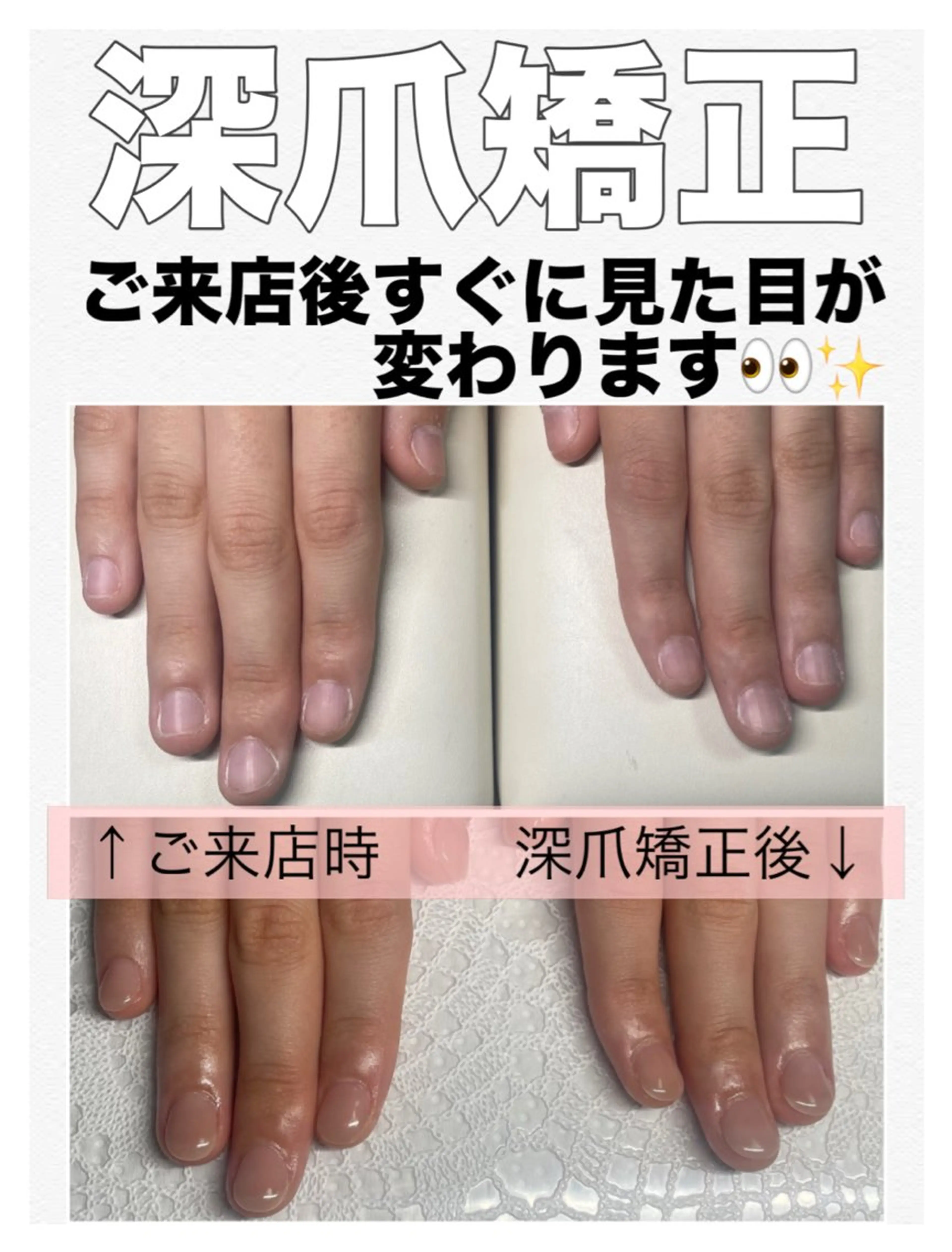 ネイル 長さ出し ロングネイル ハンドネイル ハンドケア petillant所属・nail salon petillantのネイルデザイン