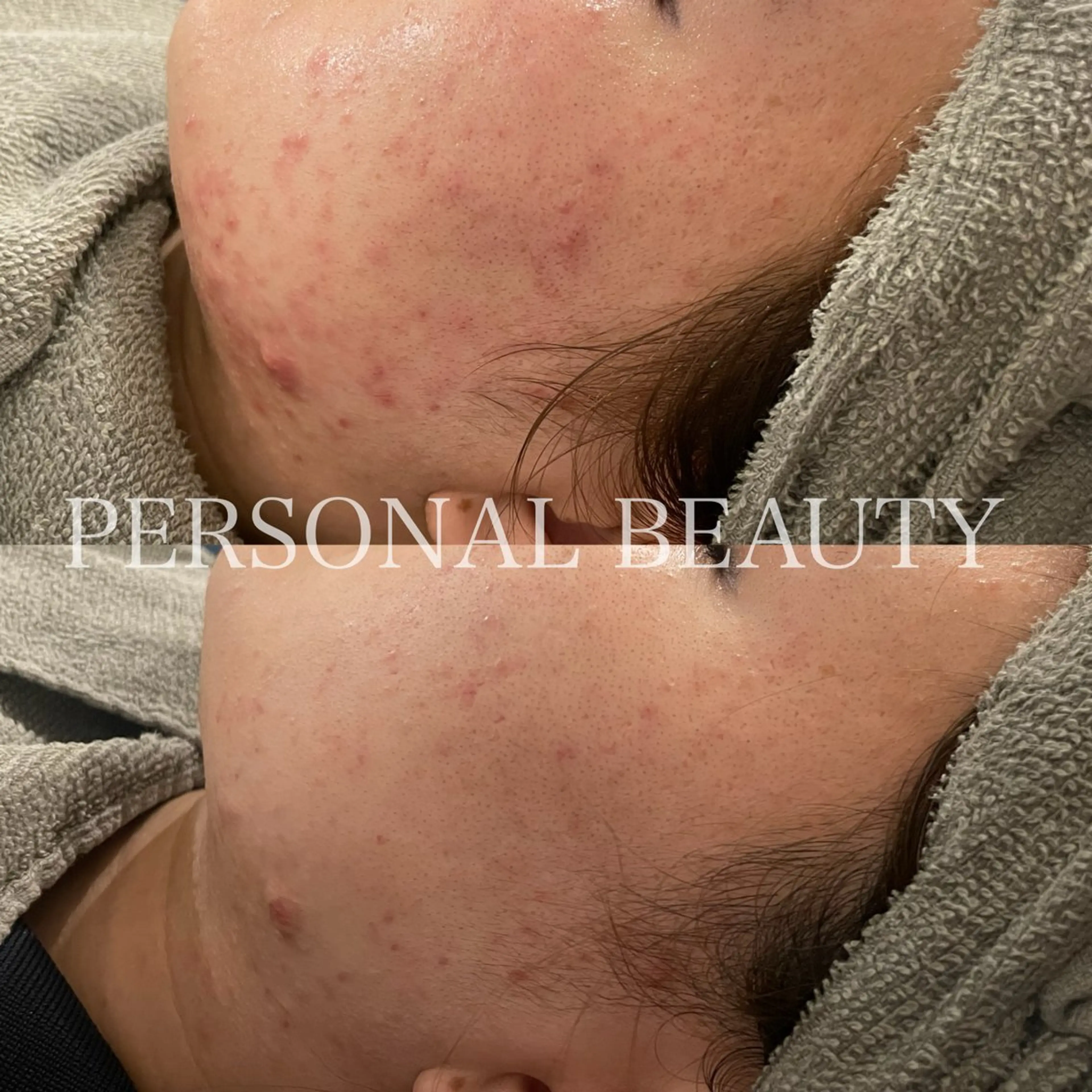 PERSONAL BEAUTY🪻のエステ・リラクイメージ