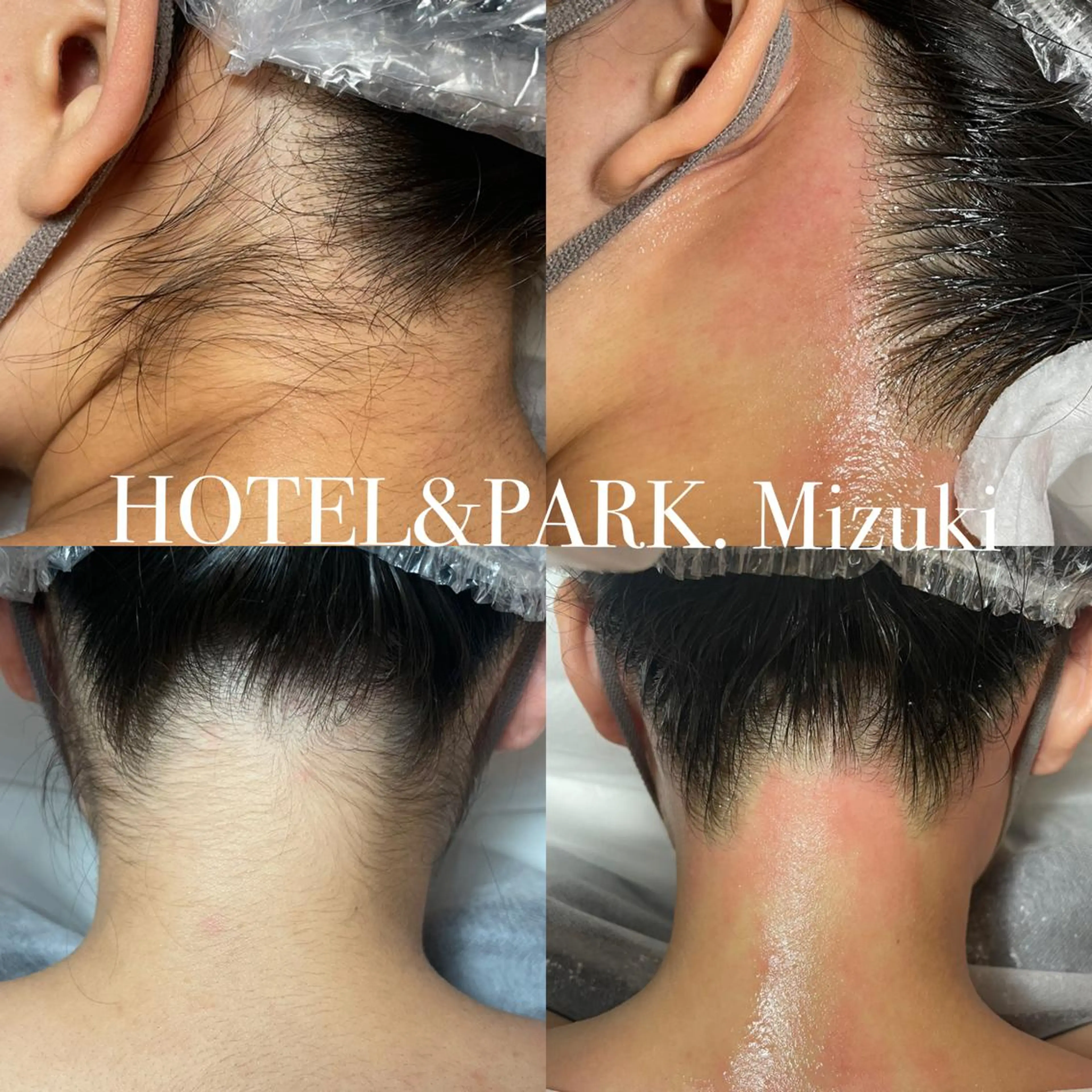 HOTEL&PARK . ワックス脱毛のエステ・リラクイメージ