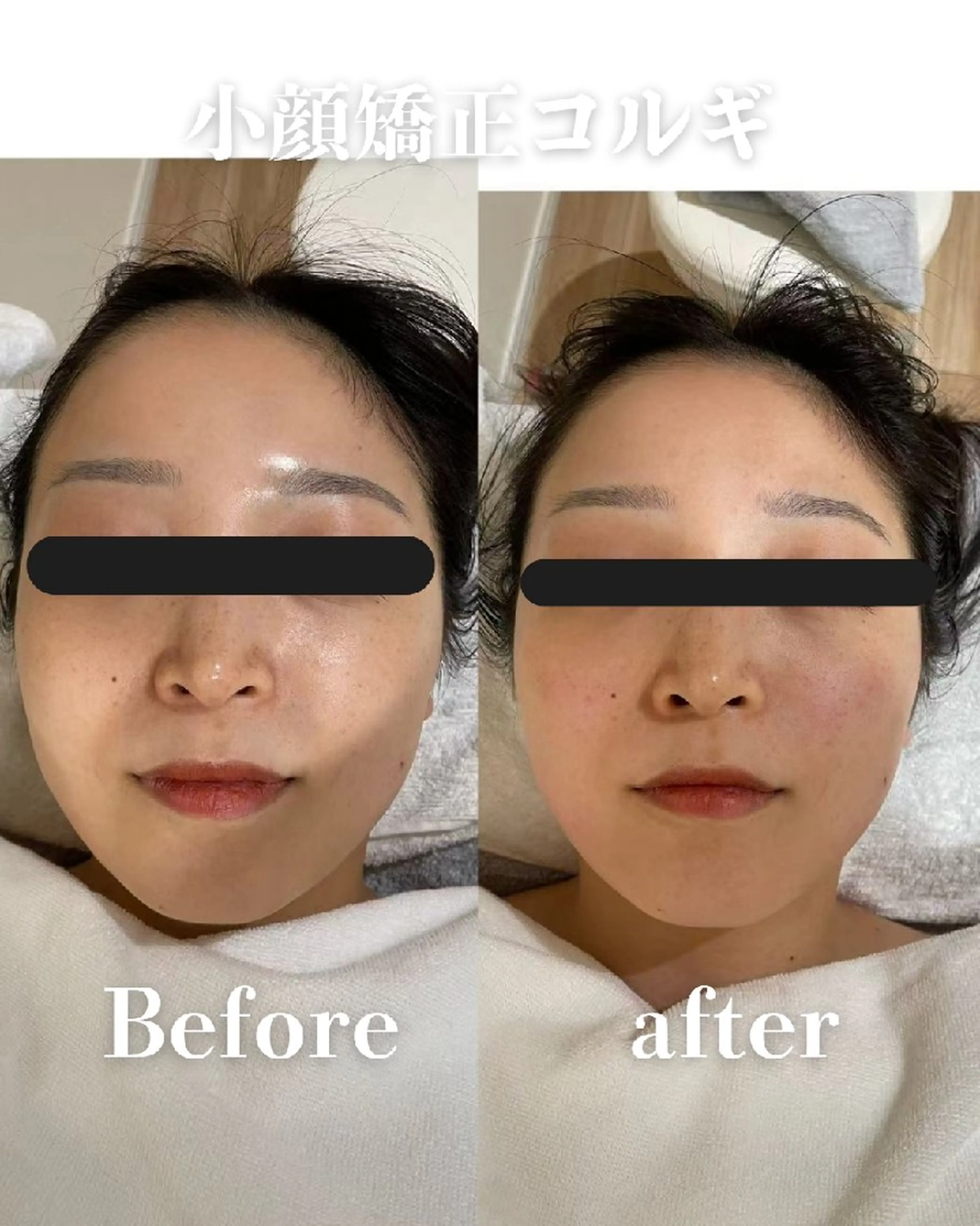 高岳/久屋大通　脱毛 コルギ🌿ENSHIのエステ・リラクイメージ