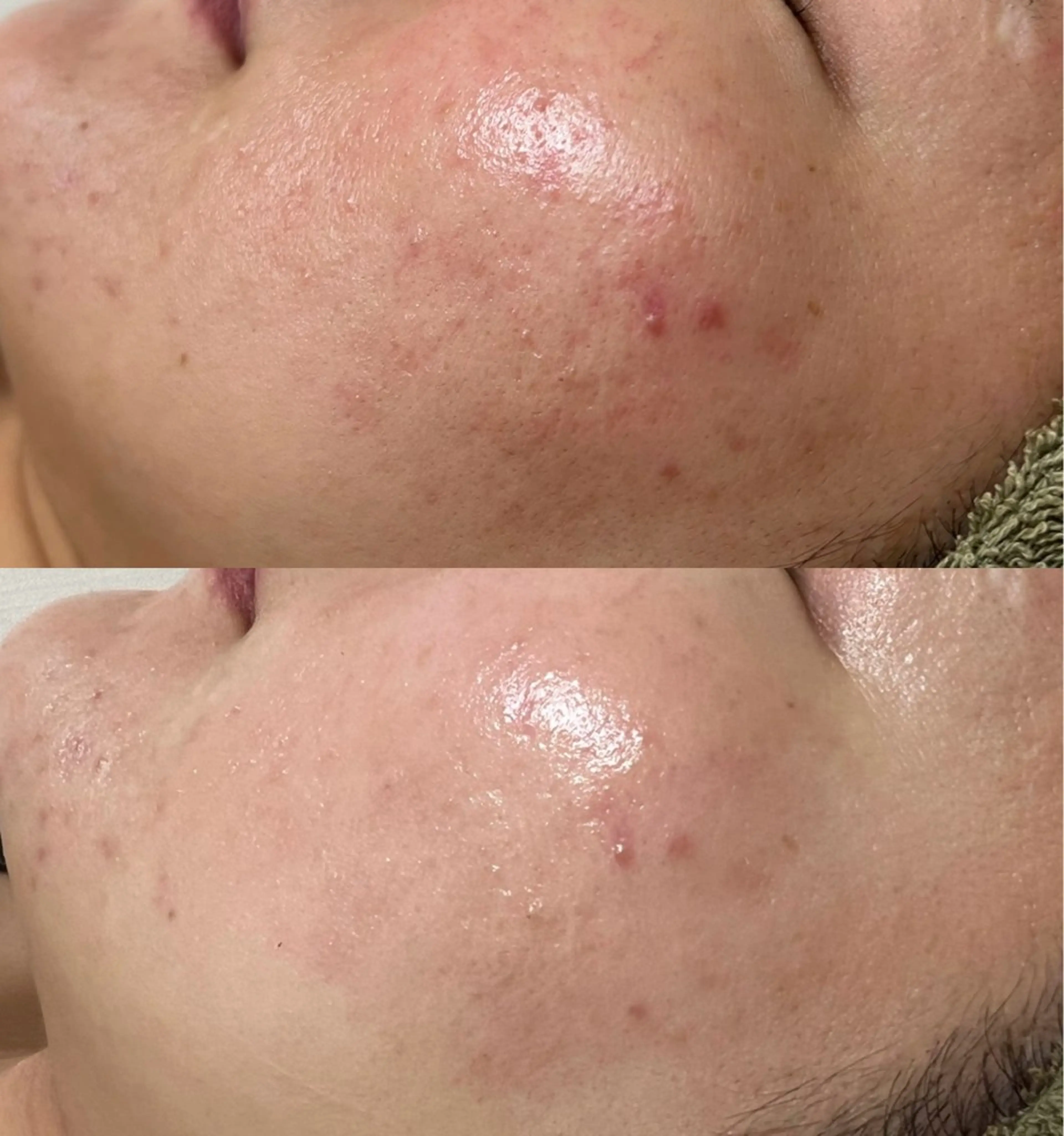 Beauty   Salon  Adiy所属・Adiy ikumiのエステ・リラクイメージ