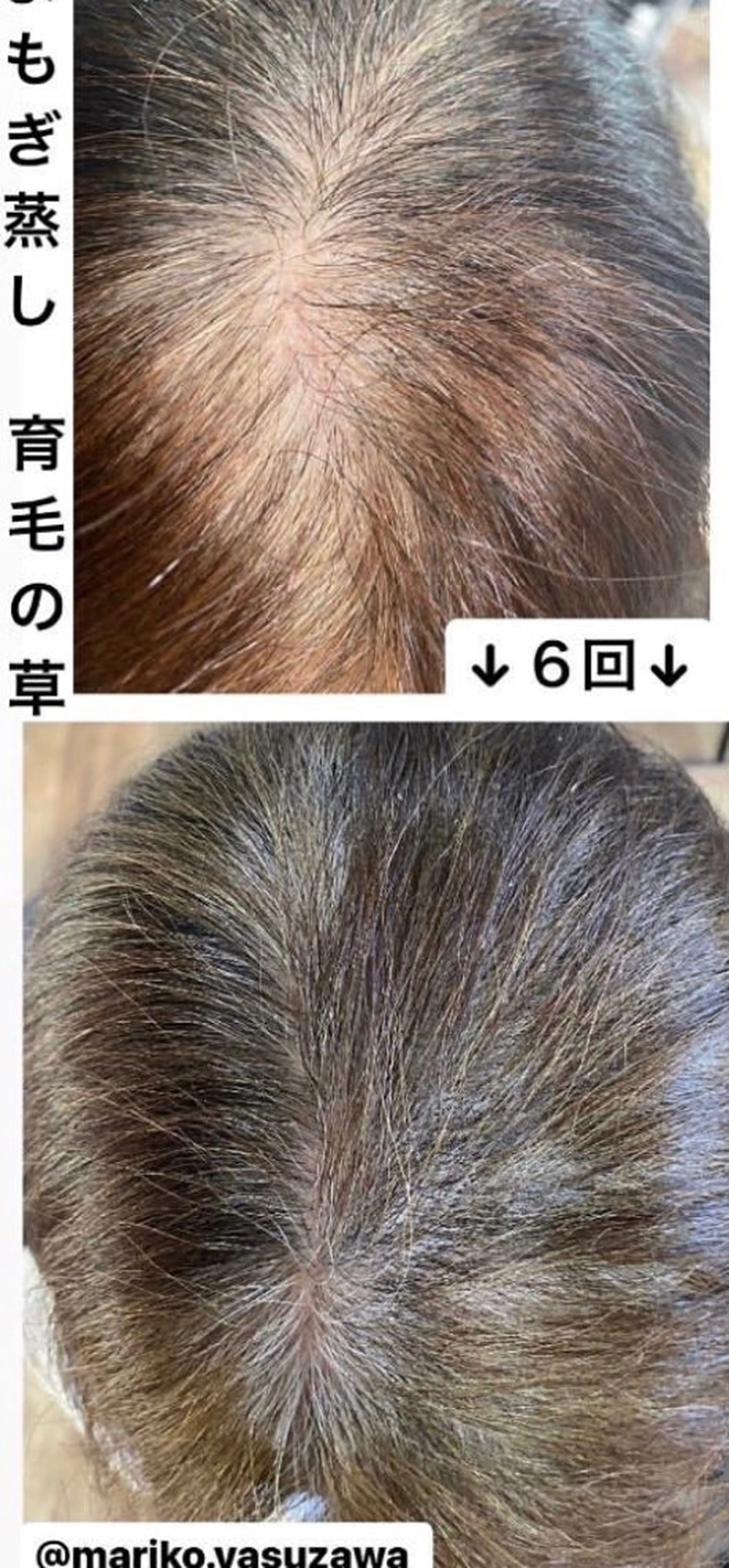 ショート private salon Dea_maris シュガーリング&パーソナルボディケア所属・シミ改善・韓国肌管理 ボディメイク痩身のその他イメージ