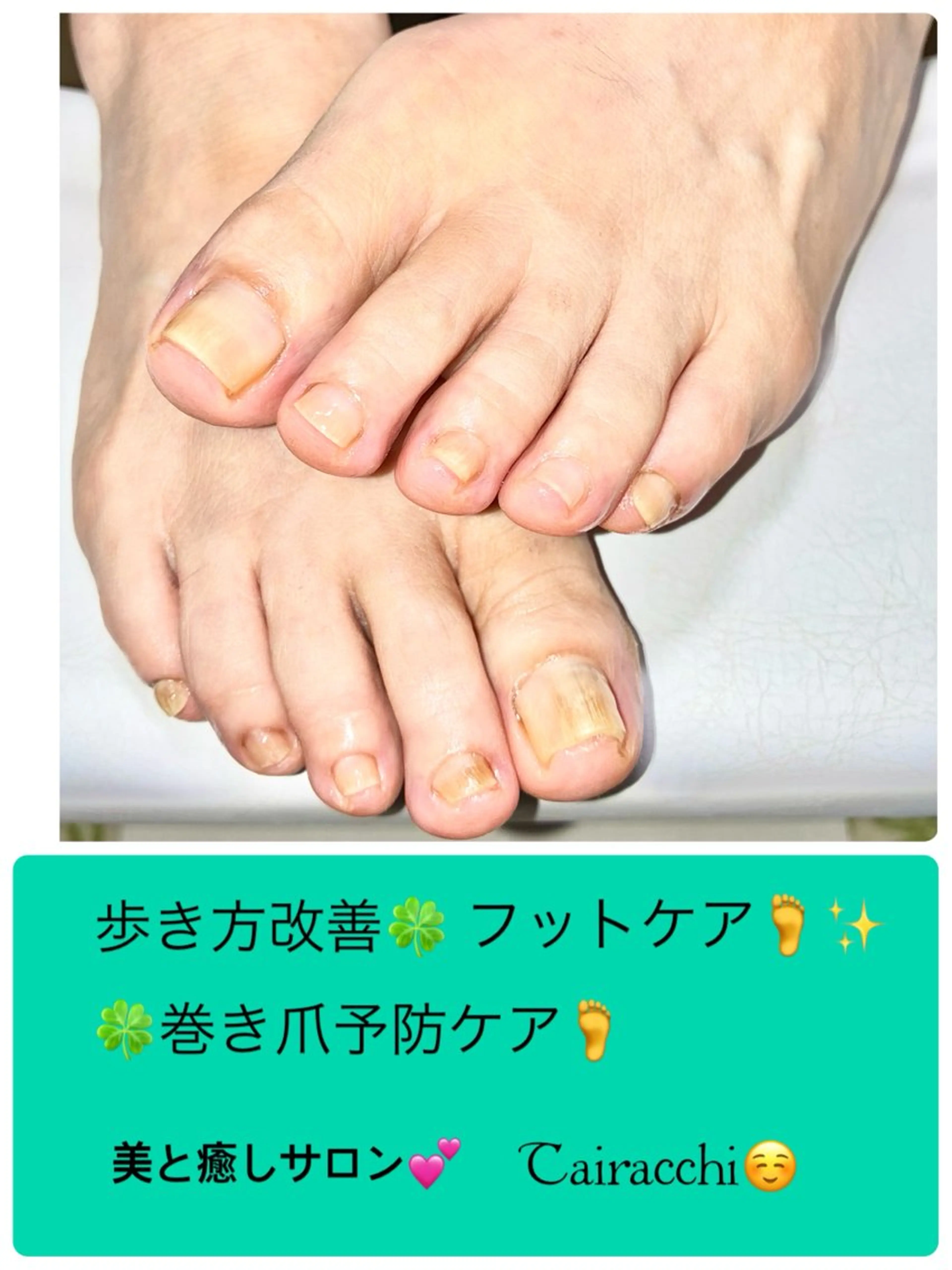 ネイル フットネイル Tairacchi ﾀｲﾗｯﾁのエステ・リラクイメージ
