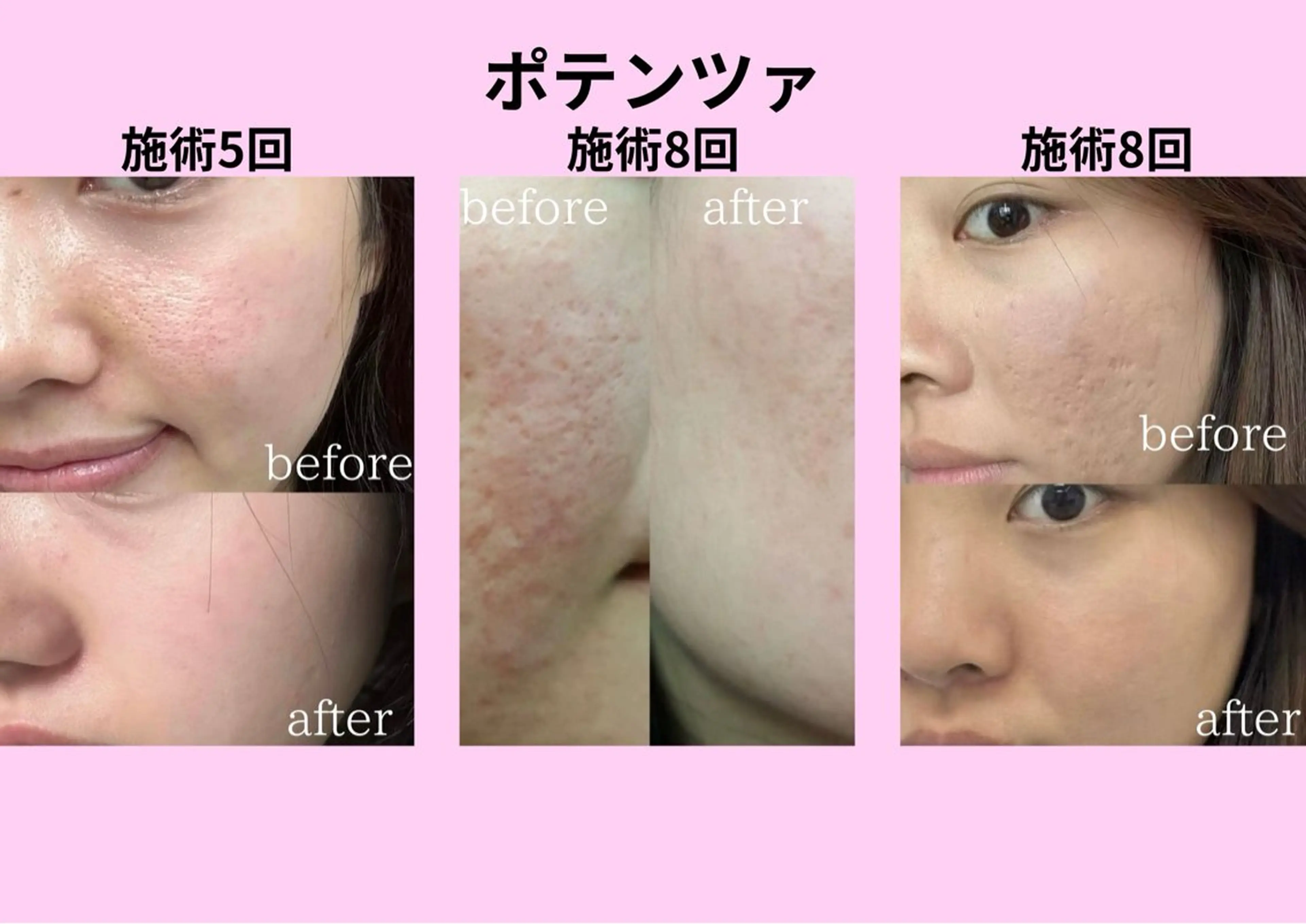 マツエク・マツパ エステ リラク 愛維美水光美肌専門店所属・愛維美水光美肌専門店 メンズレディースokのエステ・リラクイメージ