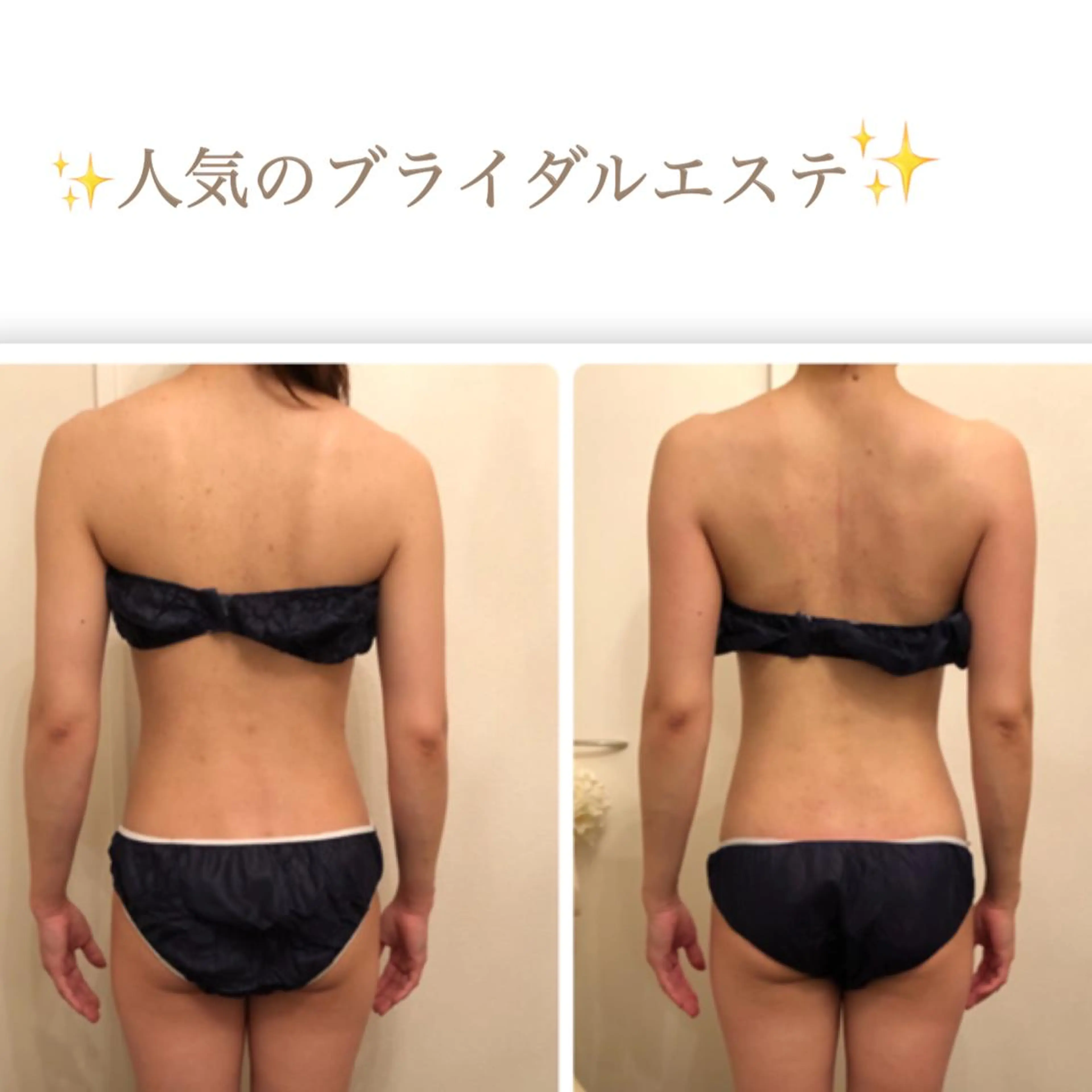 エステ リラク FLEUR大阪・整体 ・ハイフ・痩身・小顔のエステ・リラクイメージ