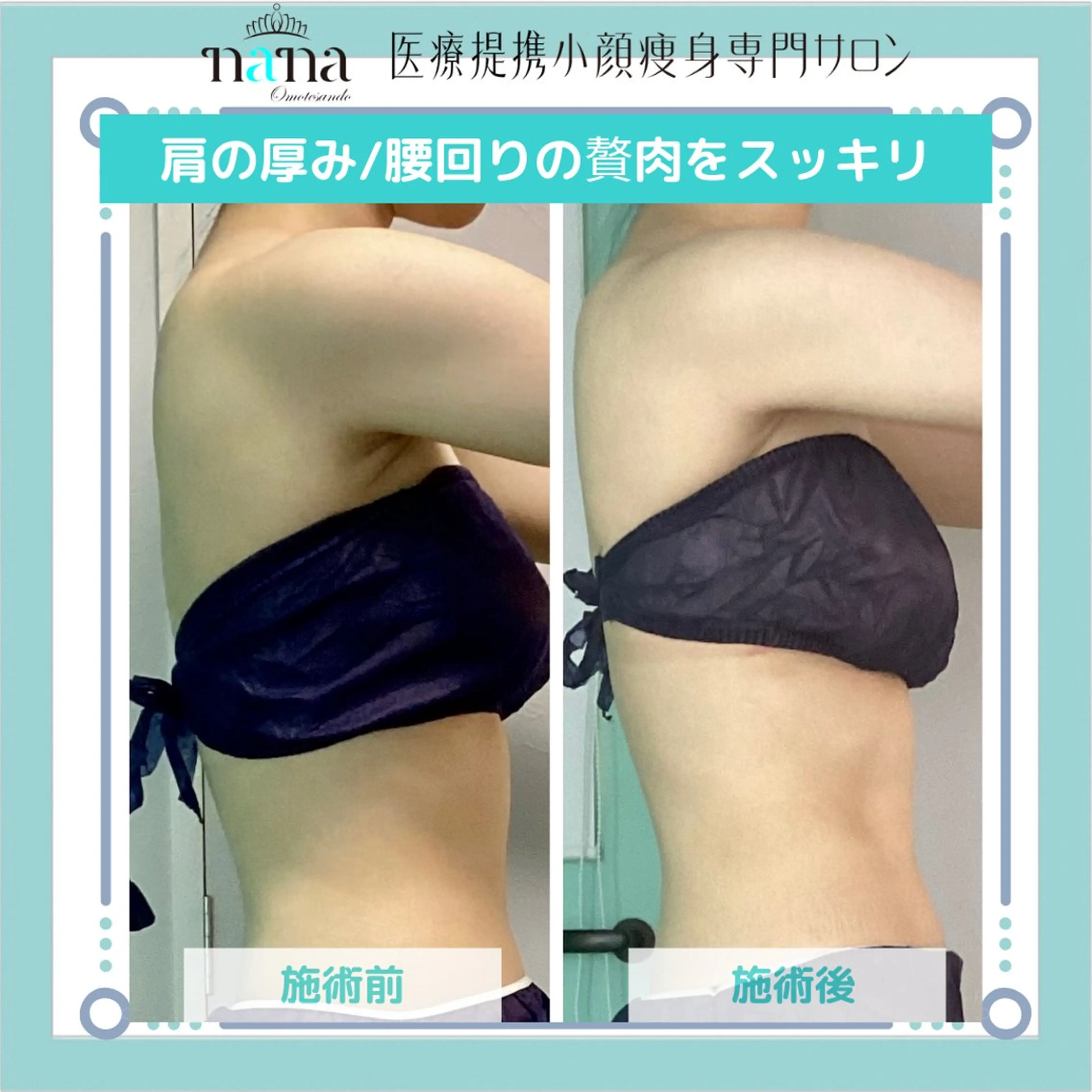 小顔痩身インディバ Nana表参道のエステ・リラクイメージ