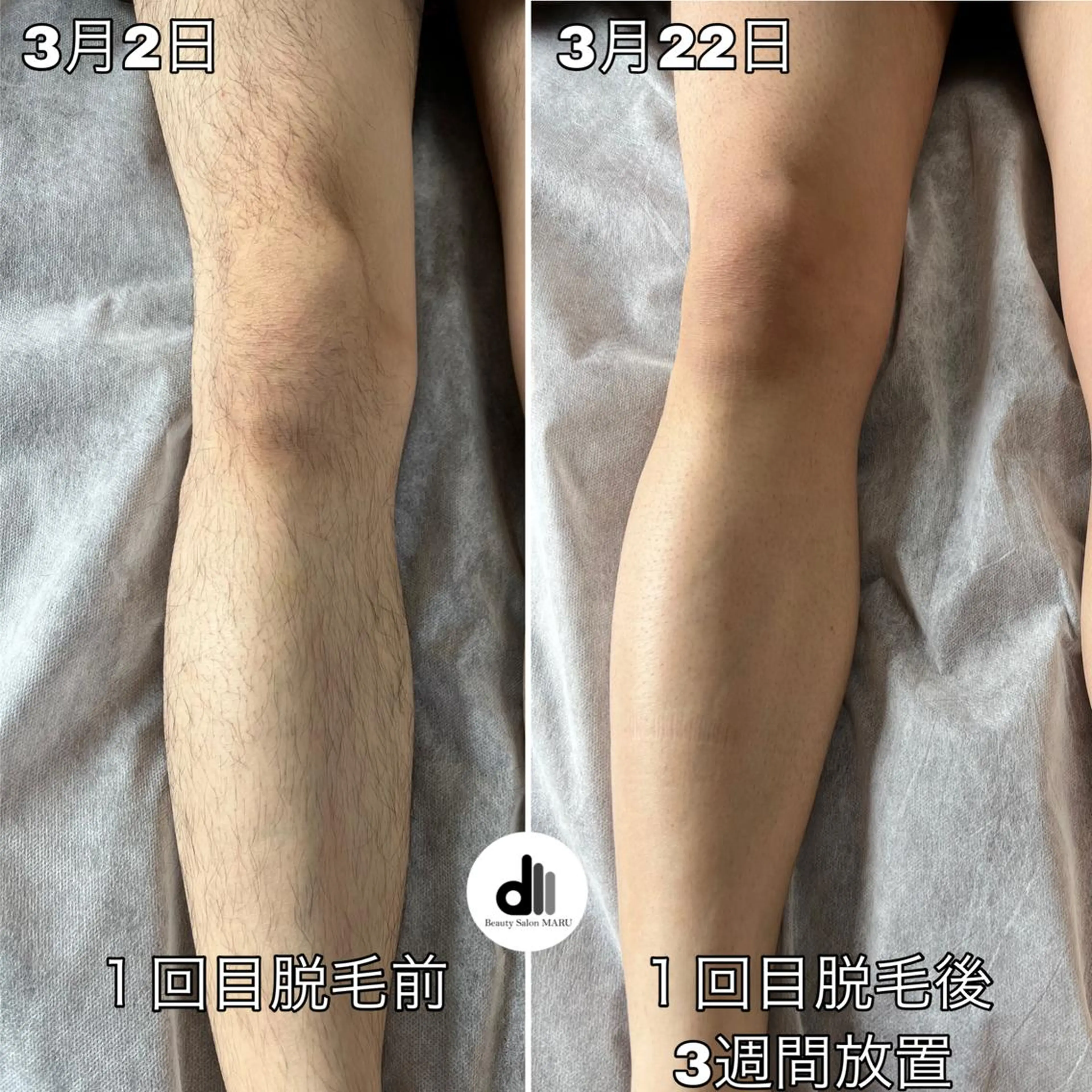 メンズ Beauty Salon MARU所属・新潟市メンズ【脱毛】 MARUのエステ・リラクイメージ