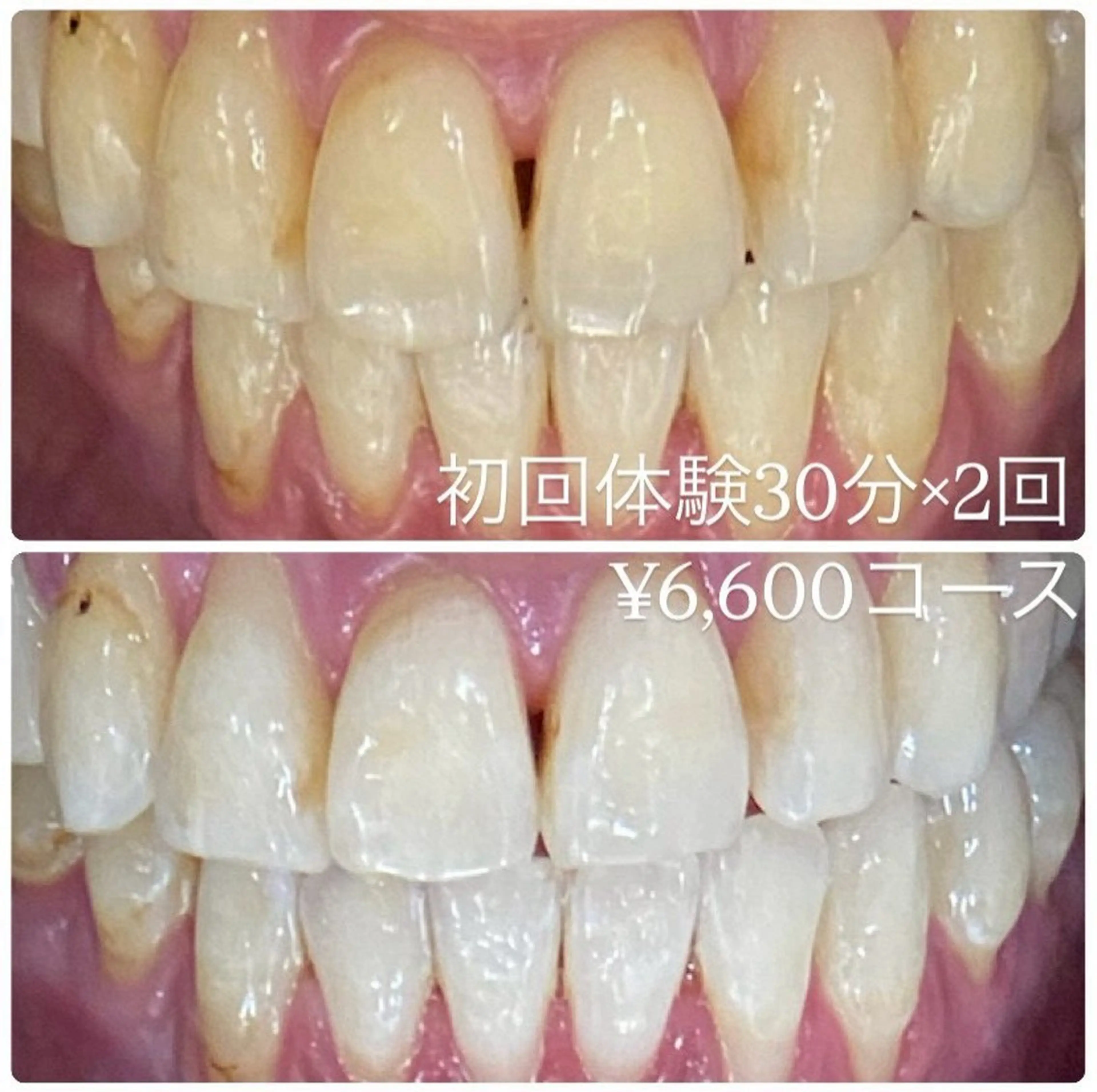 メンズ ホワイトニングルーム　川崎店所属・ホワイトニング ルーム　川崎店のその他イメージ