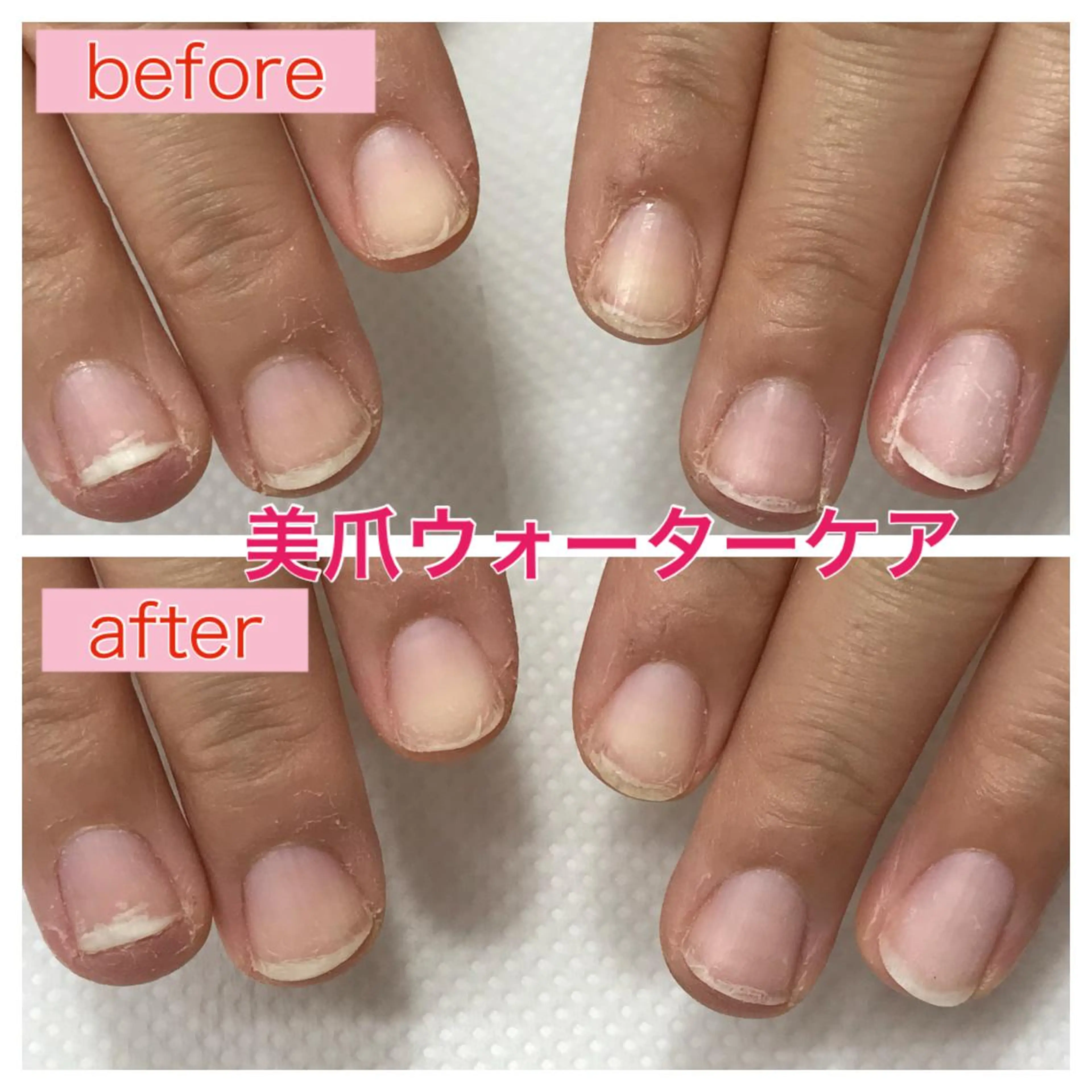 ネイル 山崎 みゆきのネイルデザイン