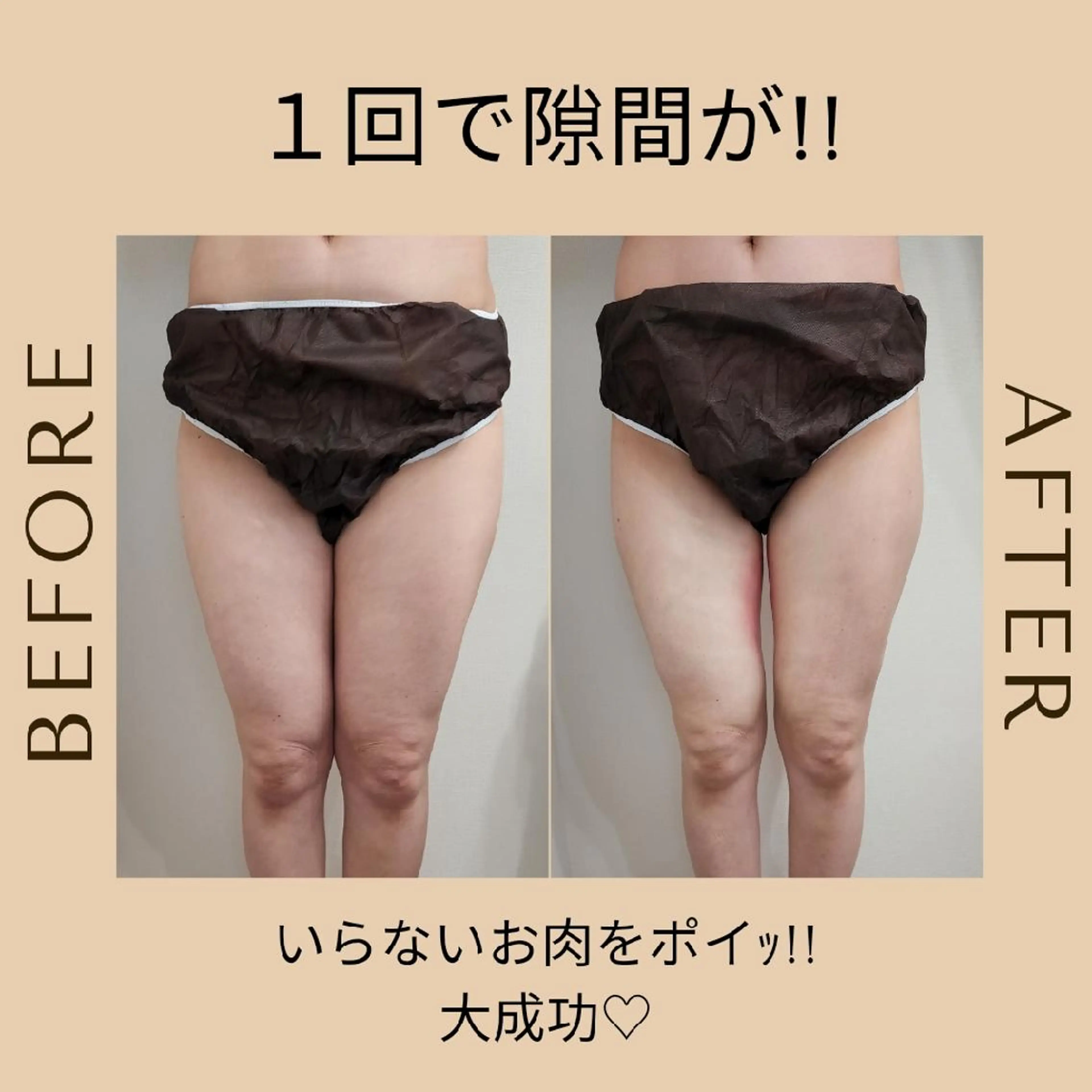 痩身・脂肪冷却サロンcoconoix [ｺｺﾉﾜ]所属・痩身・脂肪冷却サロン coconoix のエステ・リラクイメージ
