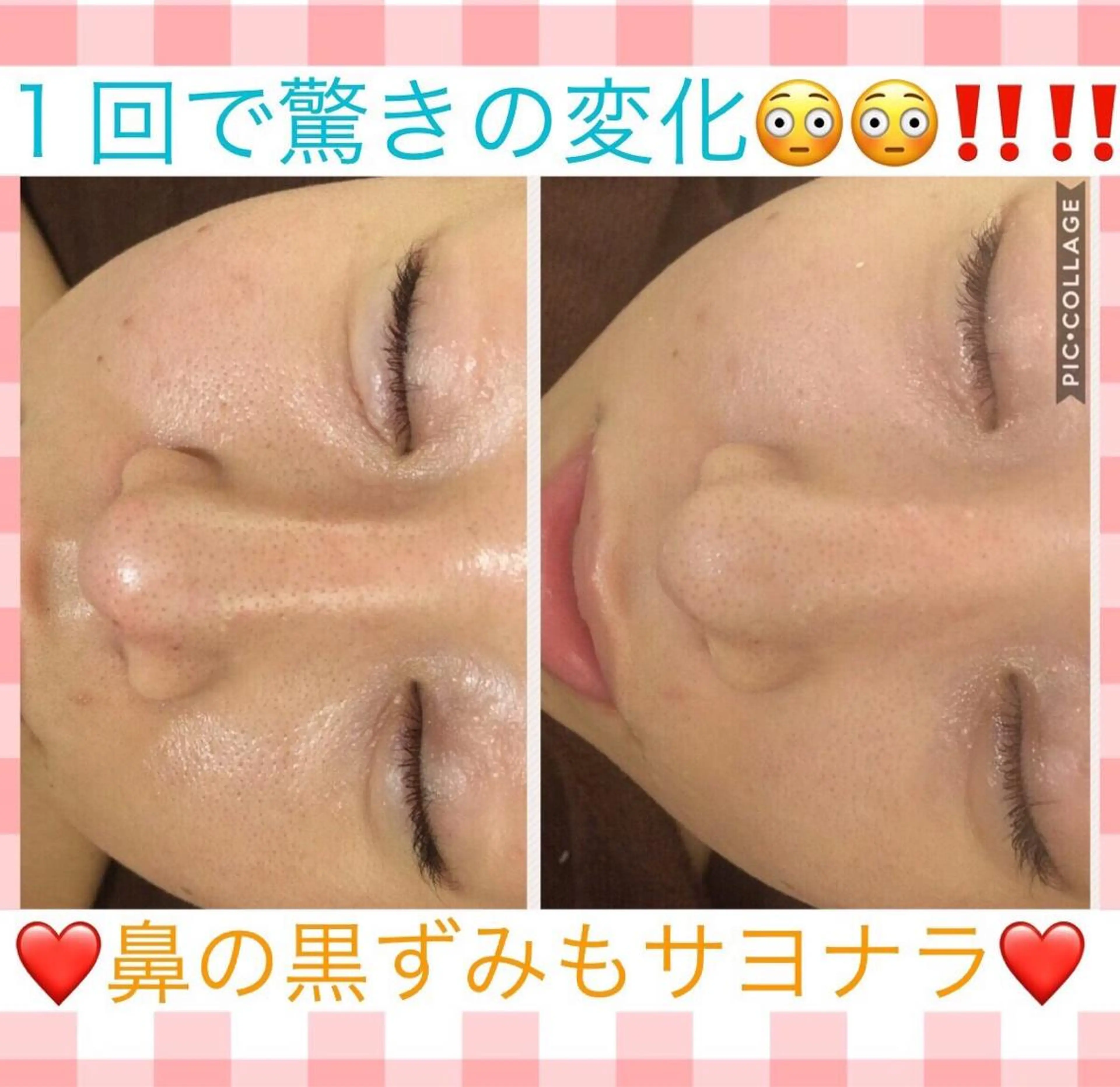 ミディアム カラー パーマ ヘアアレンジ メンズ キッズ ネイル マツエク・マツパ アクール　齋藤 ♡肌トラブル卒業のエステ・リラクイメージ