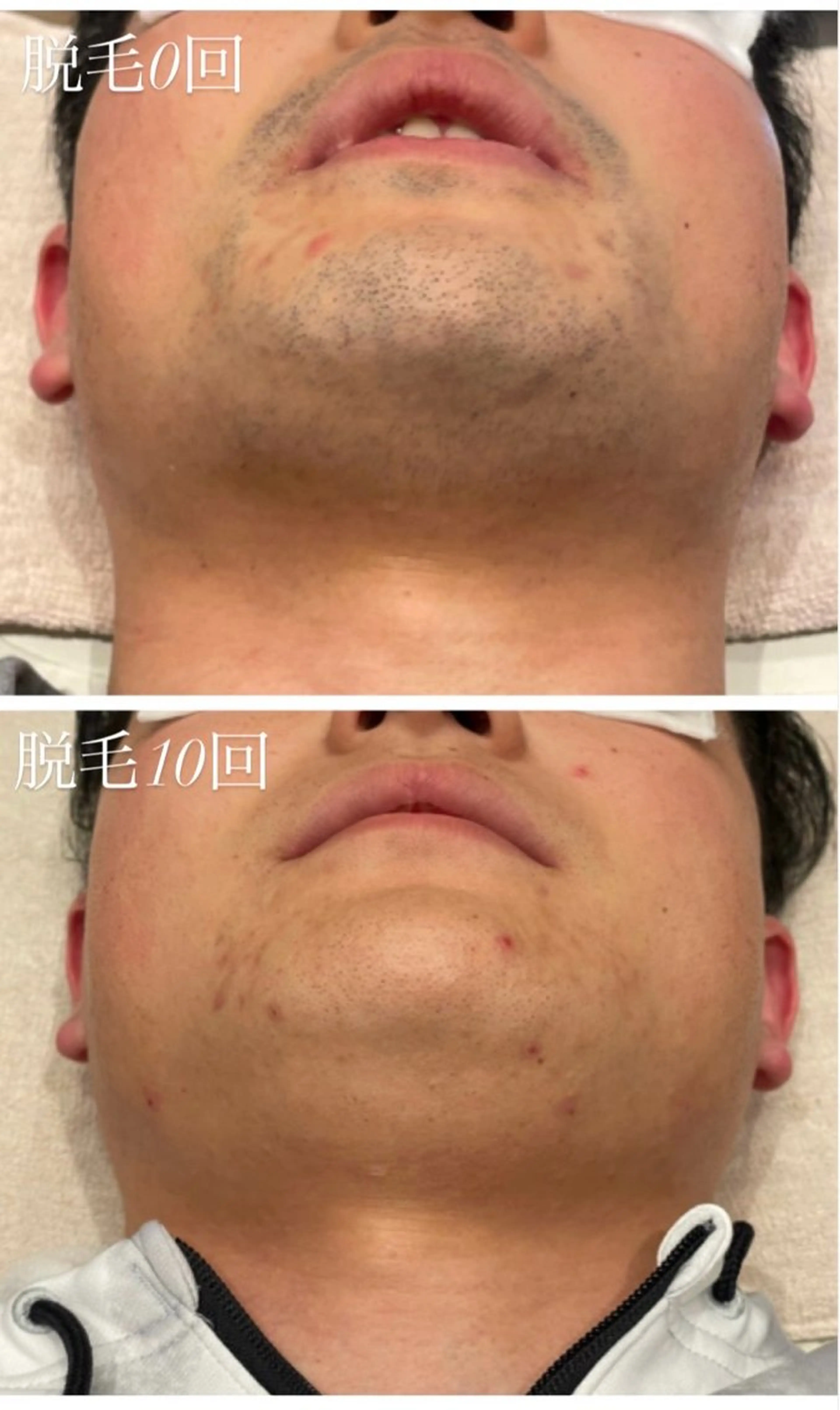 脱毛 TotalBeautySalon UNCHEL所属・Ito ayakaのその他イメージ