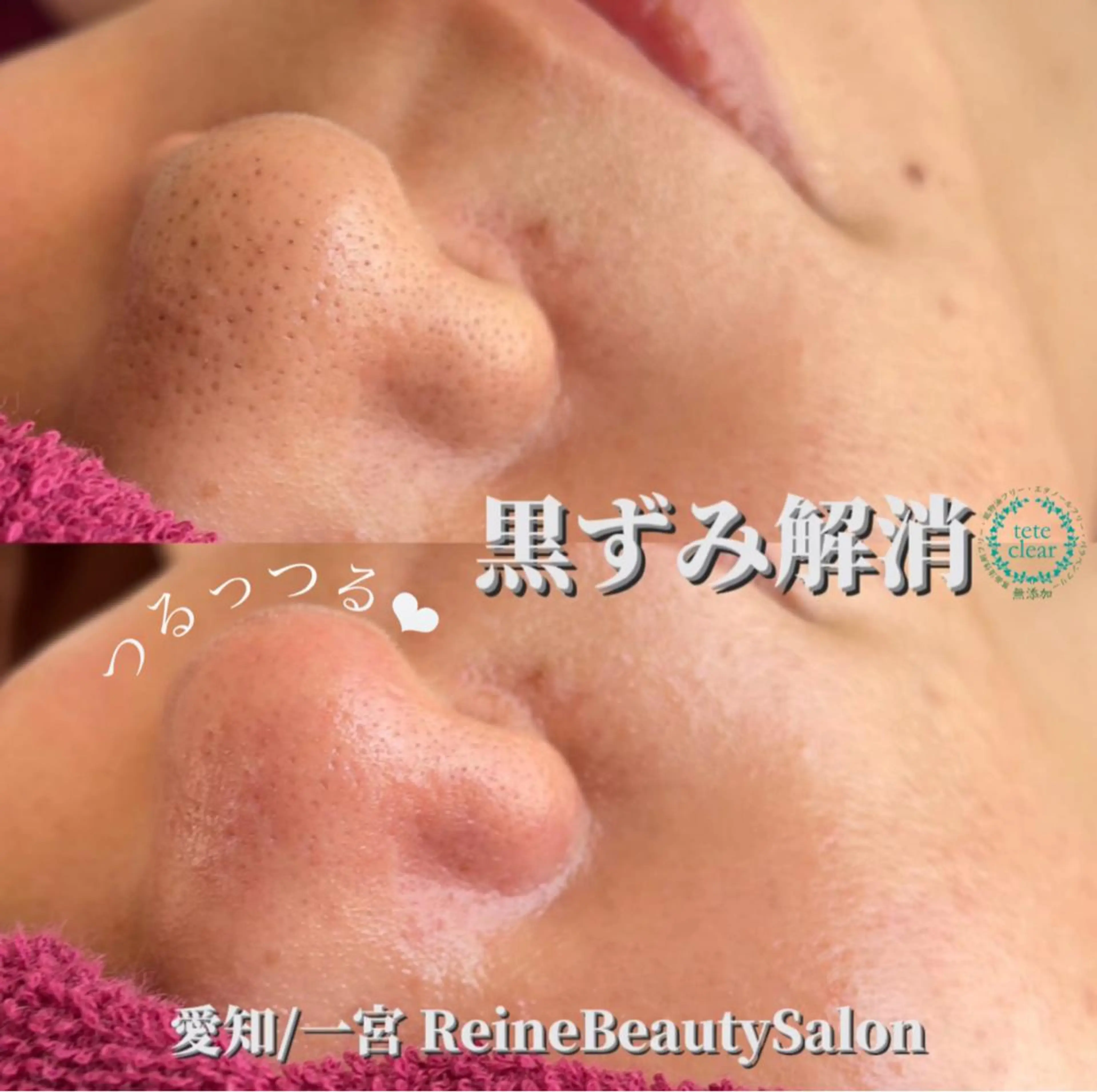 エステ Reine BeautySalon所属・毛穴/シミ肝斑/脱毛 横山梨里のエステ・リラクイメージ
