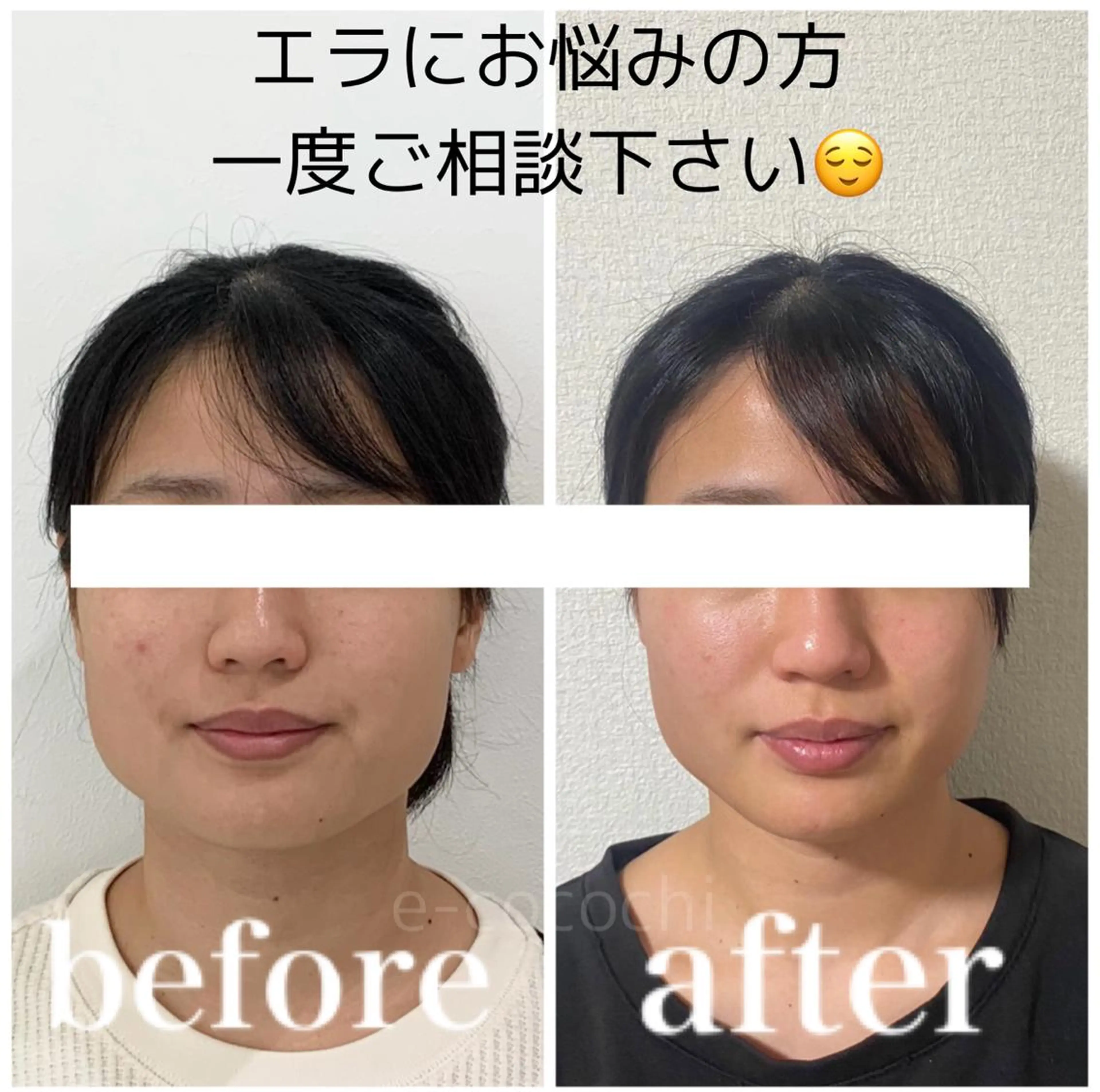 小顔と ヘッドスパのお店のエステ・リラクイメージ