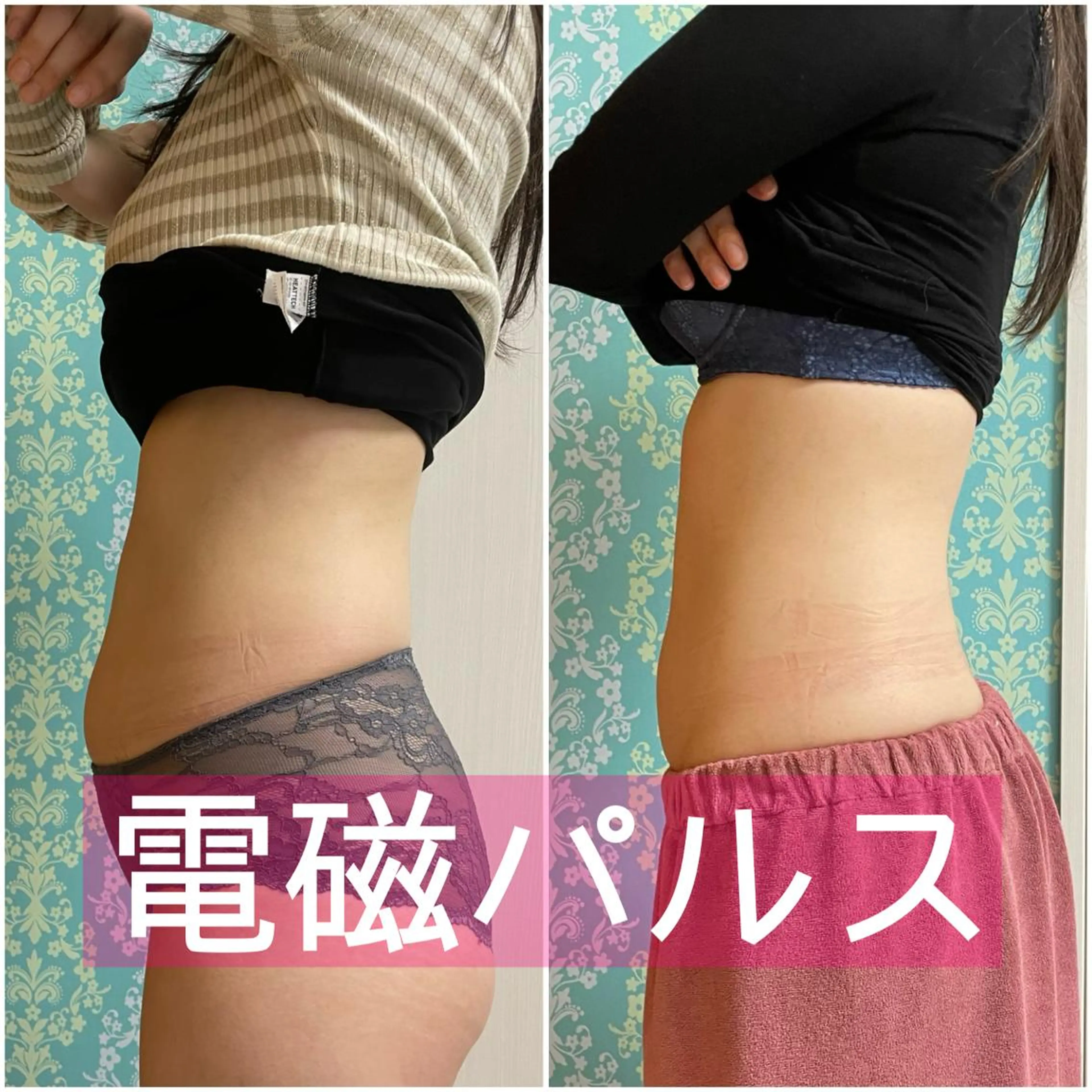毛穴＆ニキビ改善／ ワックス脱毛×光脱毛のエステ・リラクイメージ