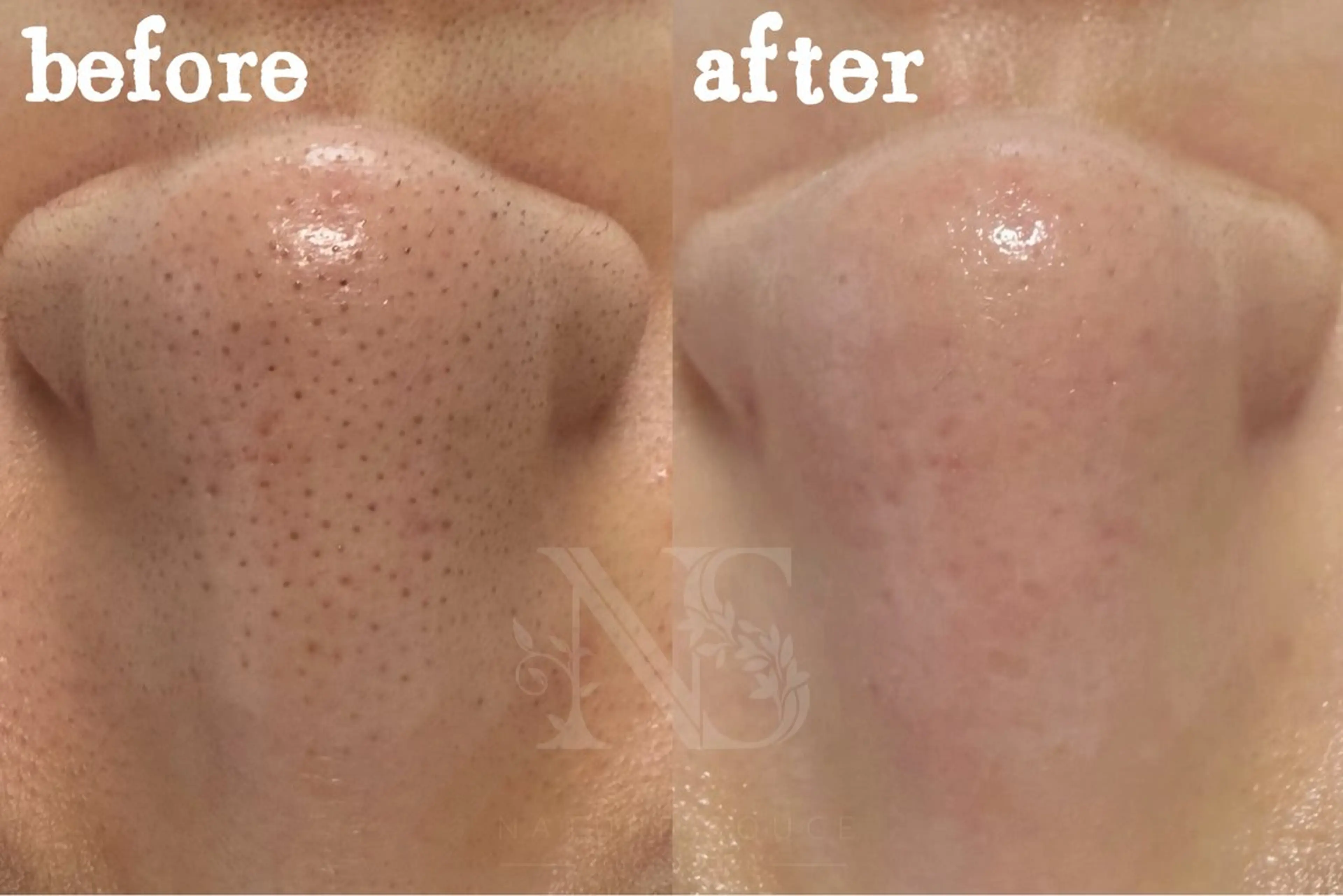 その他 Nature Souce毛穴専門店のその他イメージ