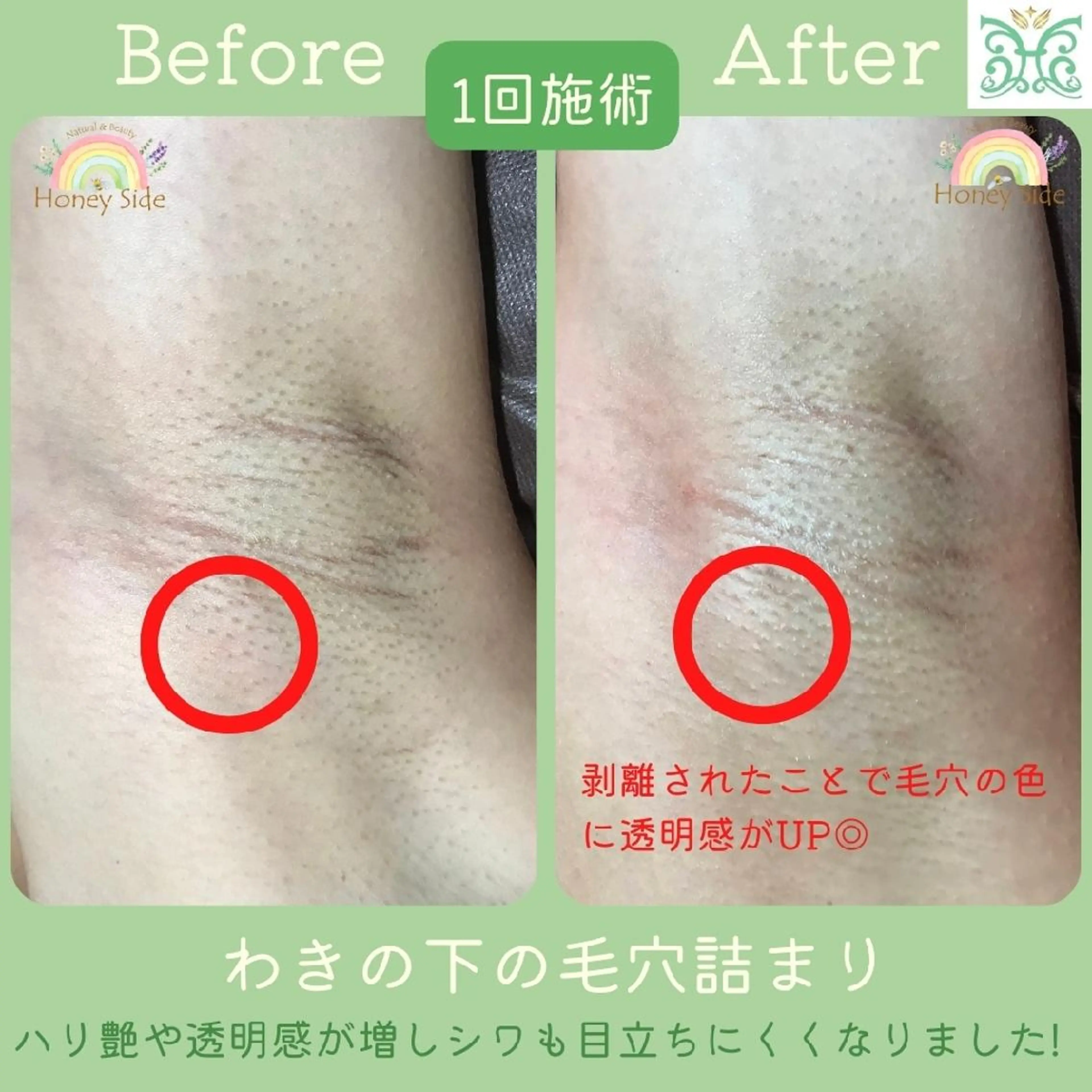 エステ 剥離するハーブ🌈 Honey Sideのエステ・リラクイメージ