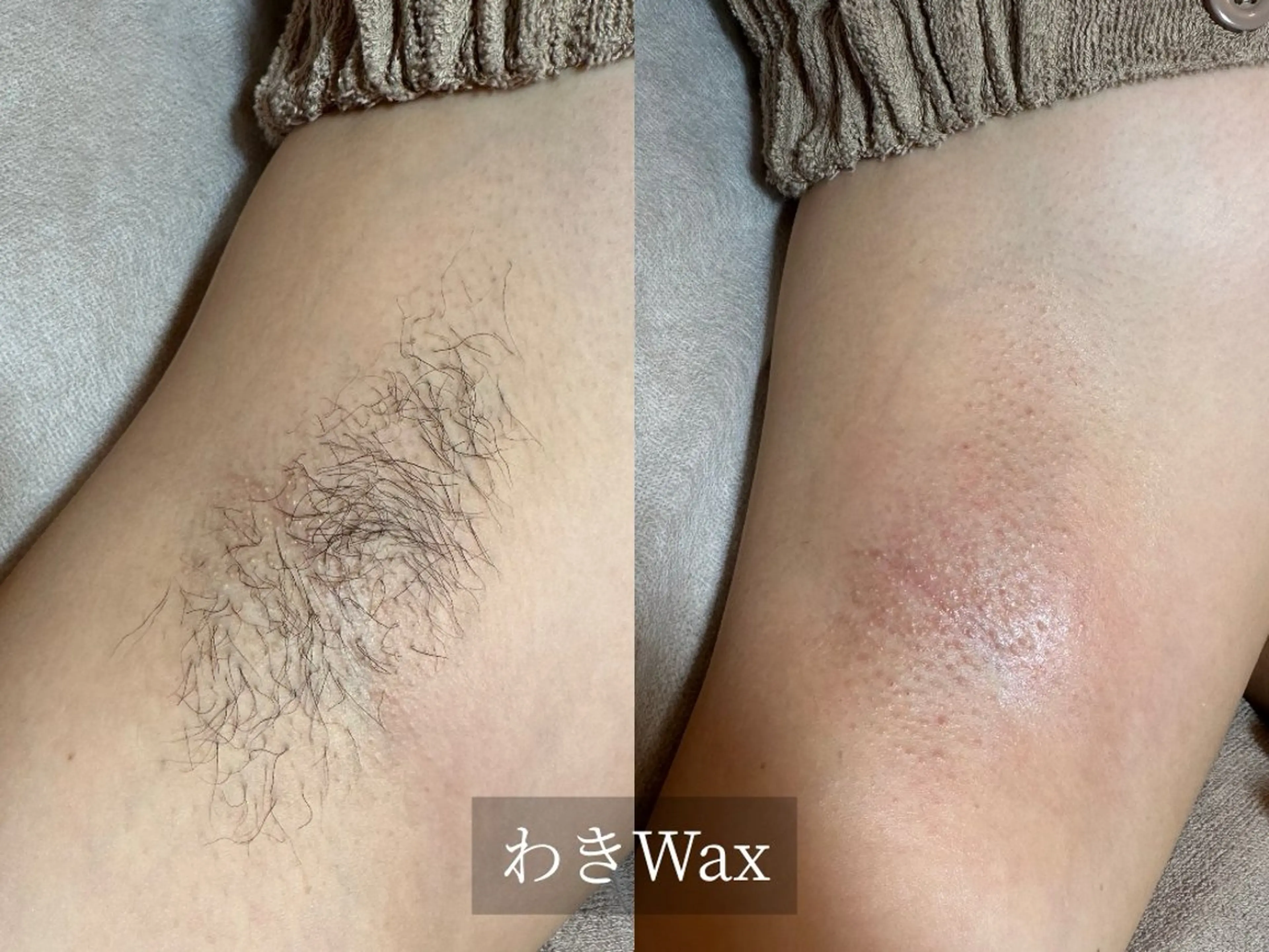 プライベート脱毛サロン　Arum所属・脱毛サロン Arumのエステ・リラクイメージ