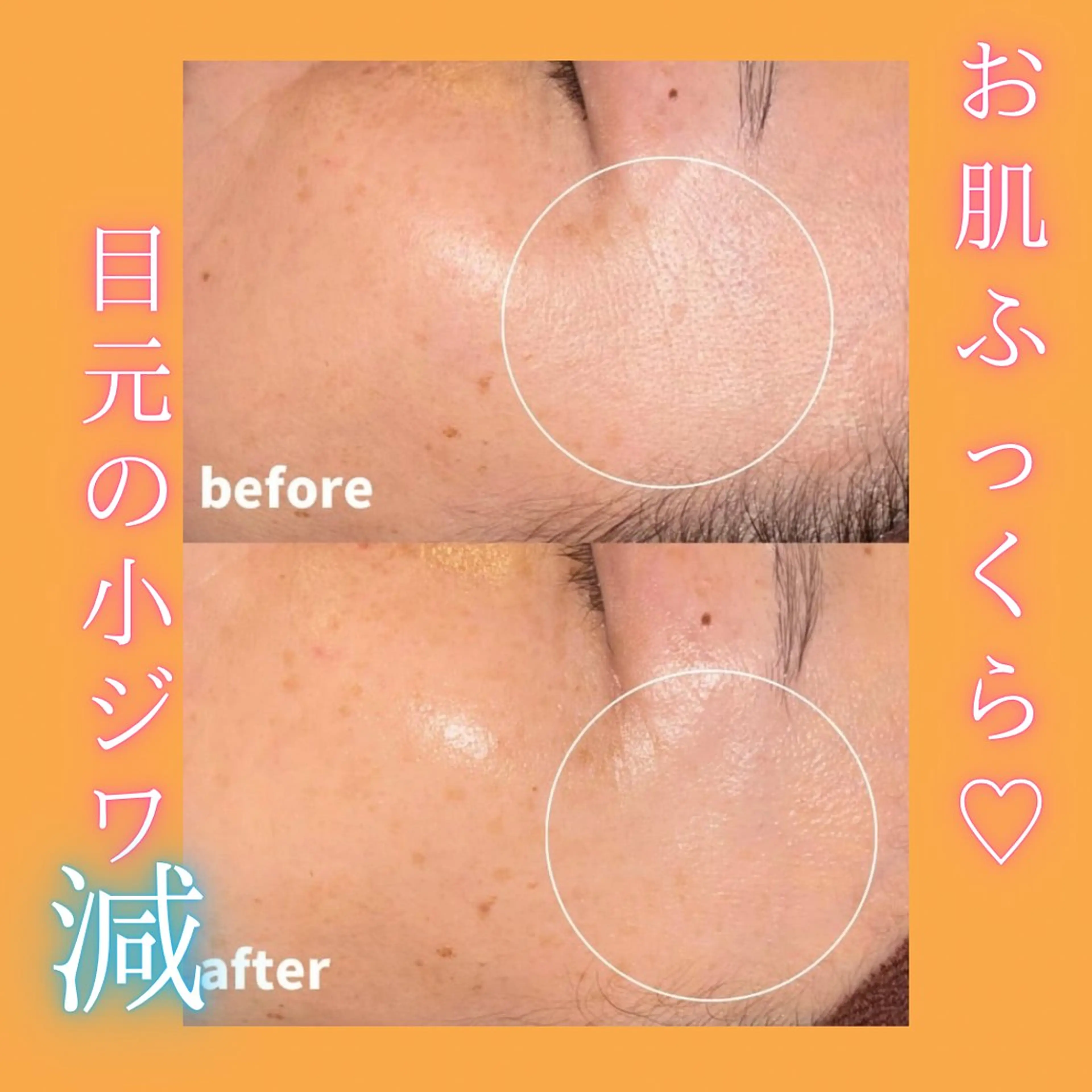 【高保湿❗️乾燥時期オススメ❄️】瞬時にシワ埋め🧖‍♀️✨本物のシルク使用でツルんと陶器肌💕シワ・凹凸・ツヤ弾力の写真