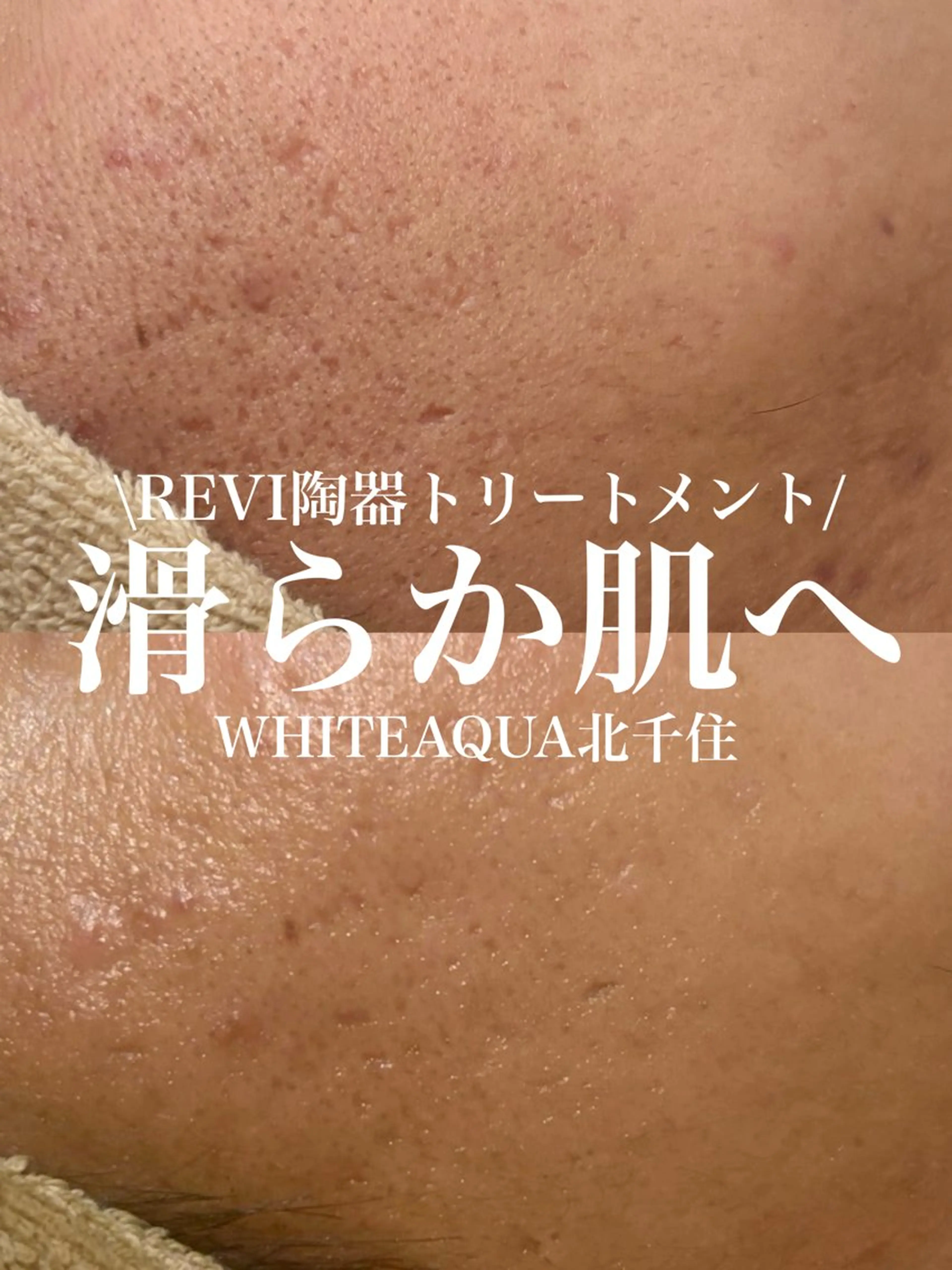 エステ WHITE AQUA 北千住店のエステ・リラクイメージ