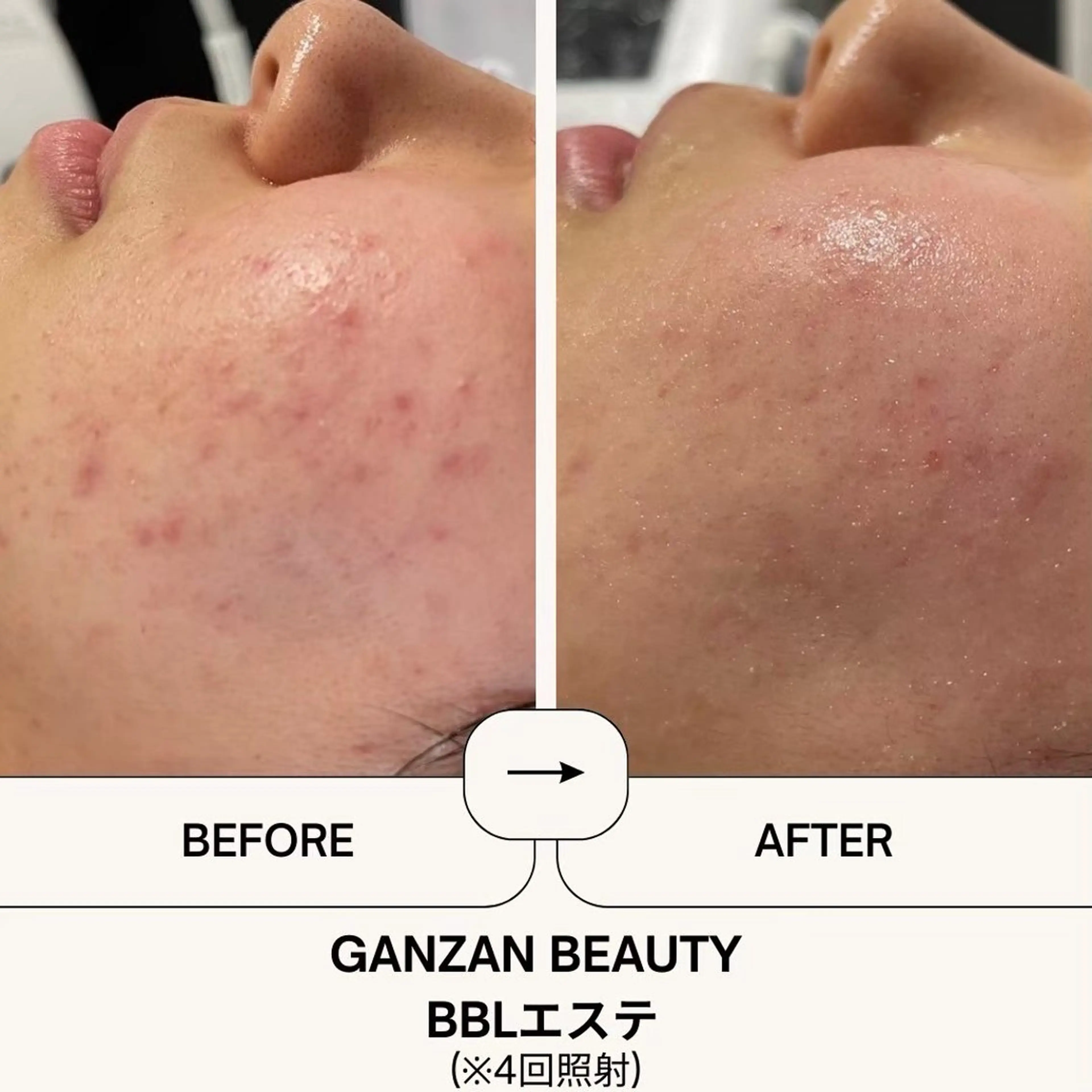 エステ ganzan beauty所属・GANZAN yukariのエステ・リラクイメージ