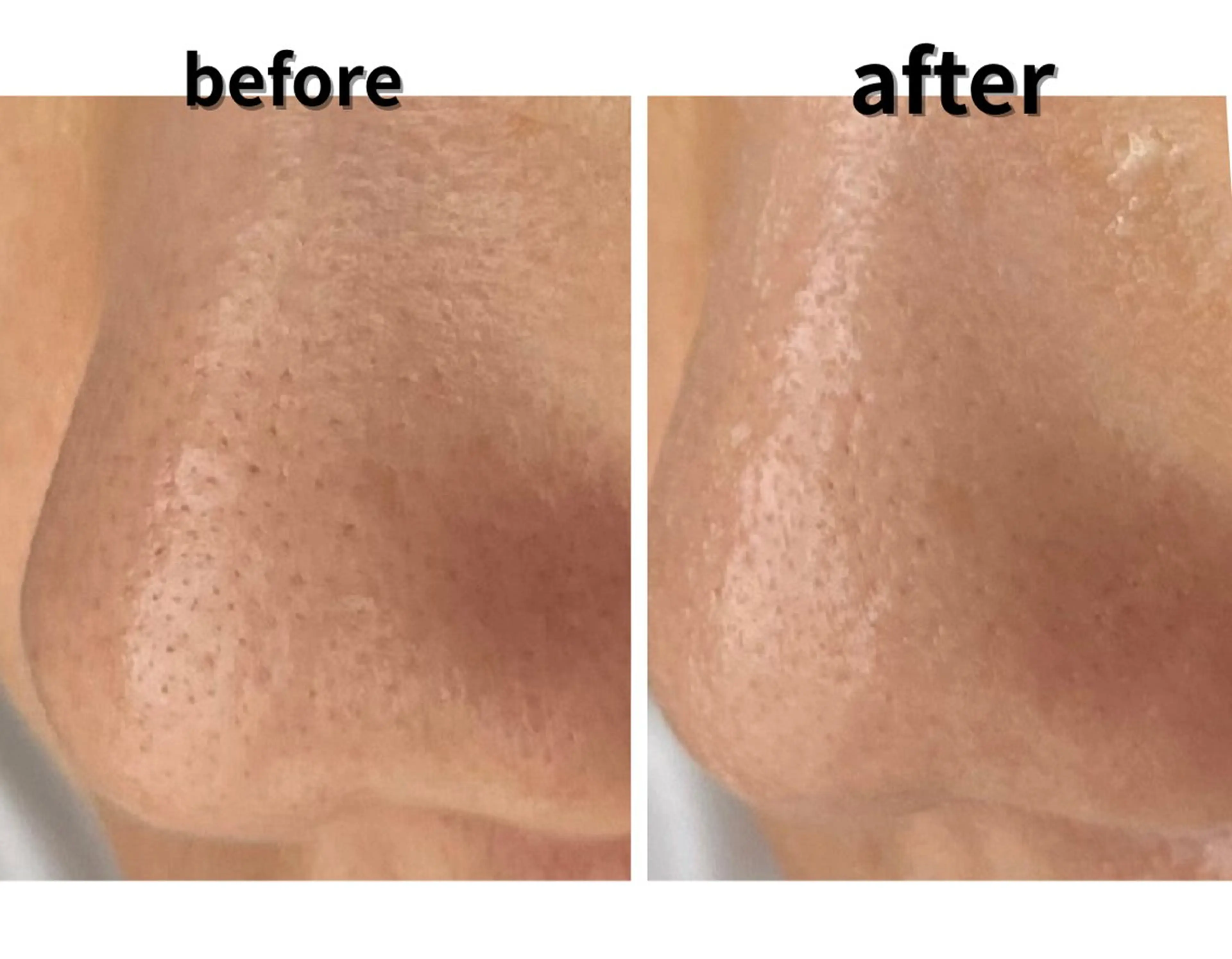 エステ エステサロン Libertaのその他イメージ