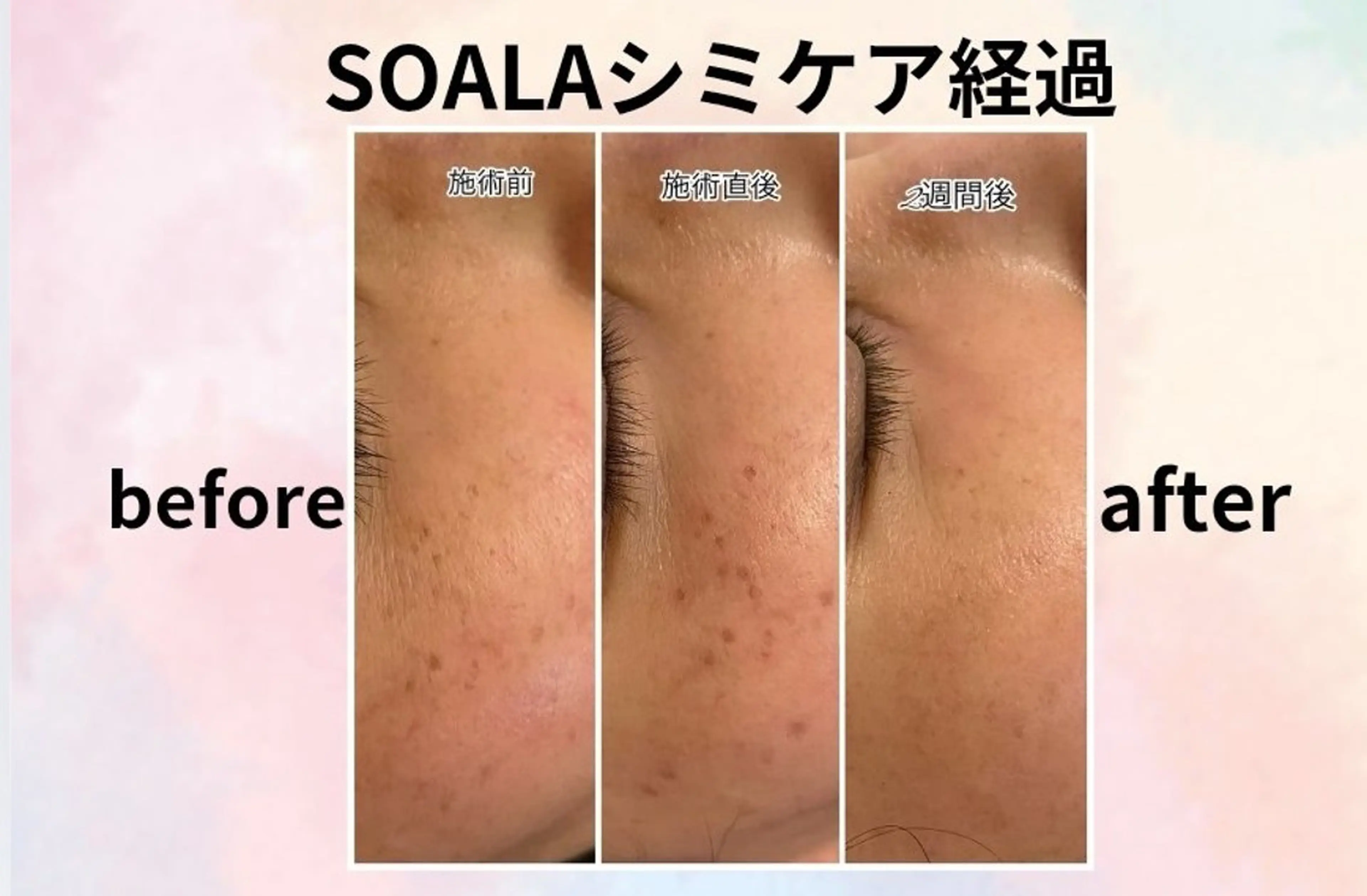 エステ 美容整体師  江上のエステ・リラクイメージ