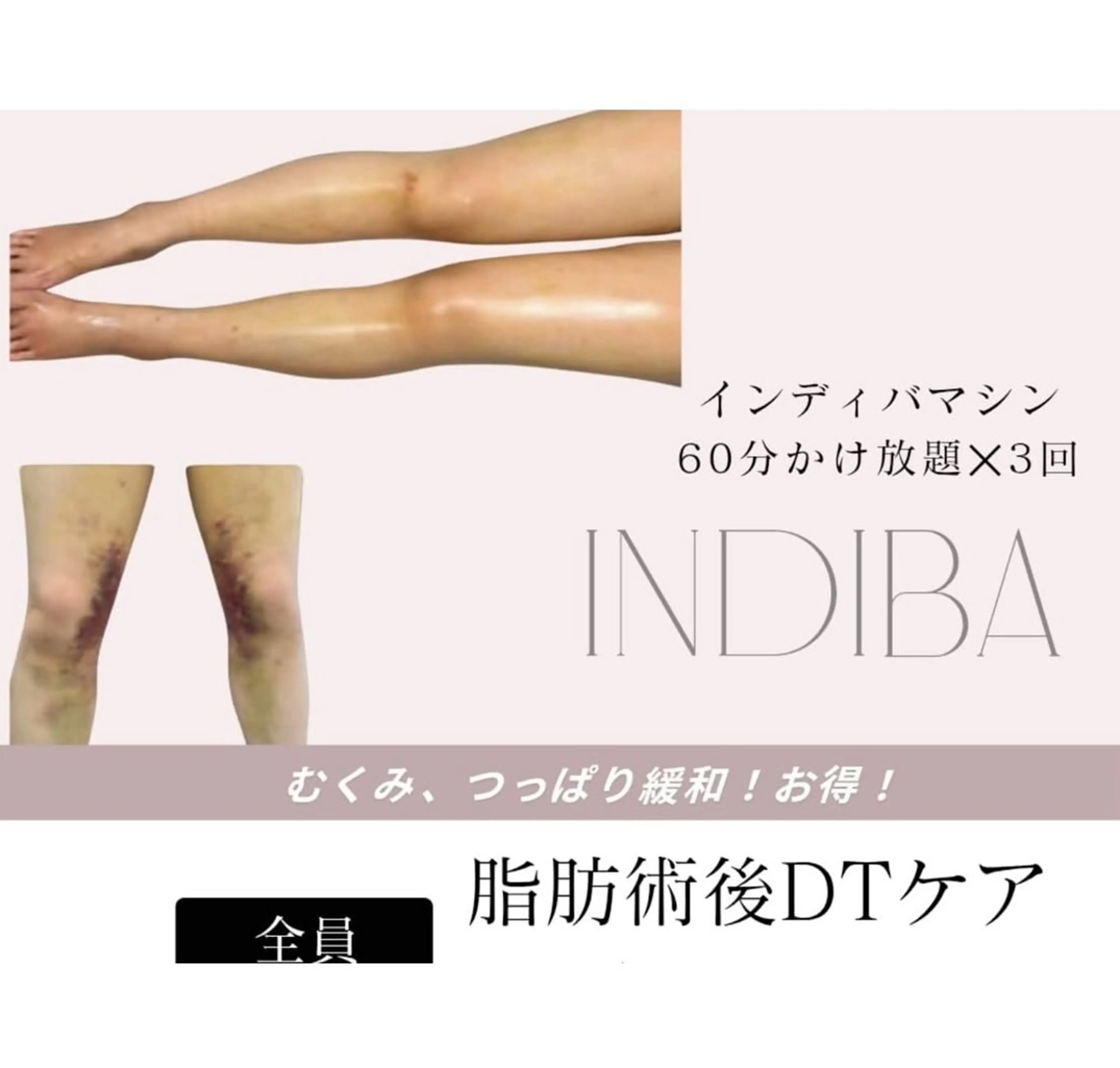 【美容施術後/温活ケア】120分｜2回目ご来店特典✨全身じんわり温め＆巡りサポートケアの写真