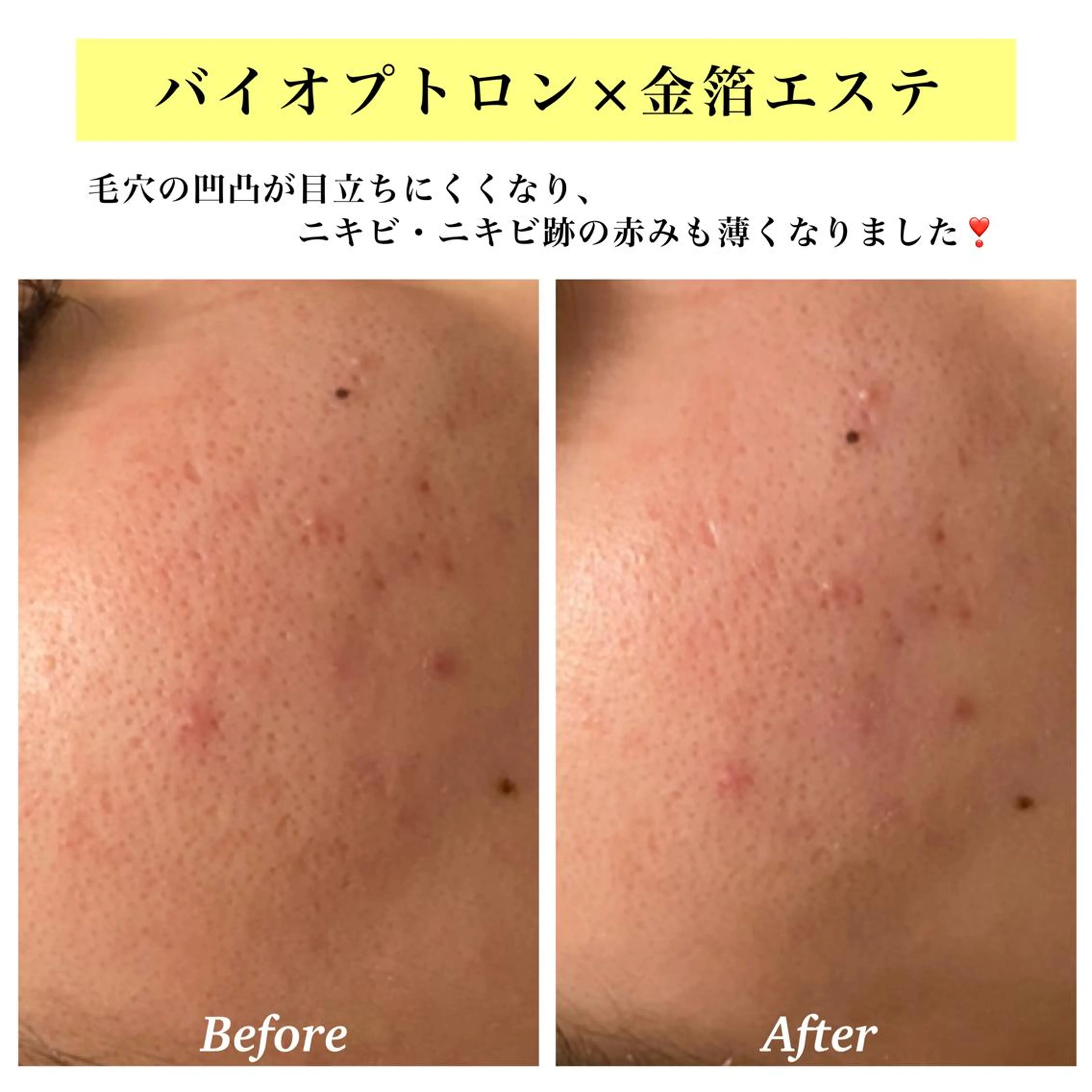 エステ リラク Bellesthe (ベルエステ)のエステ・リラクイメージ