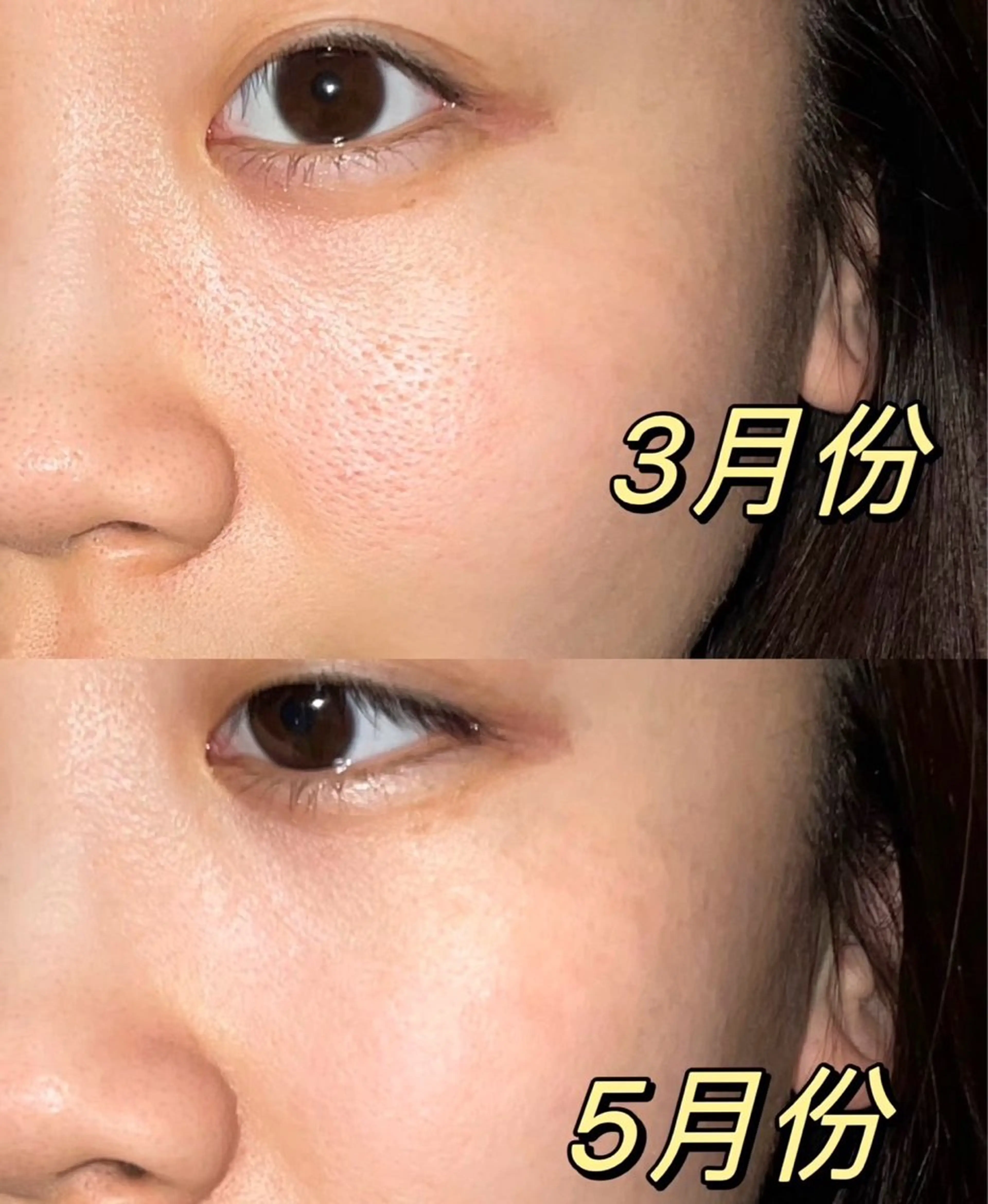 ショート エステ リラク 愛維美水光美肌専門店所属・愛維美水光美肌専門店 メンズレディースokのエステ・リラクイメージ