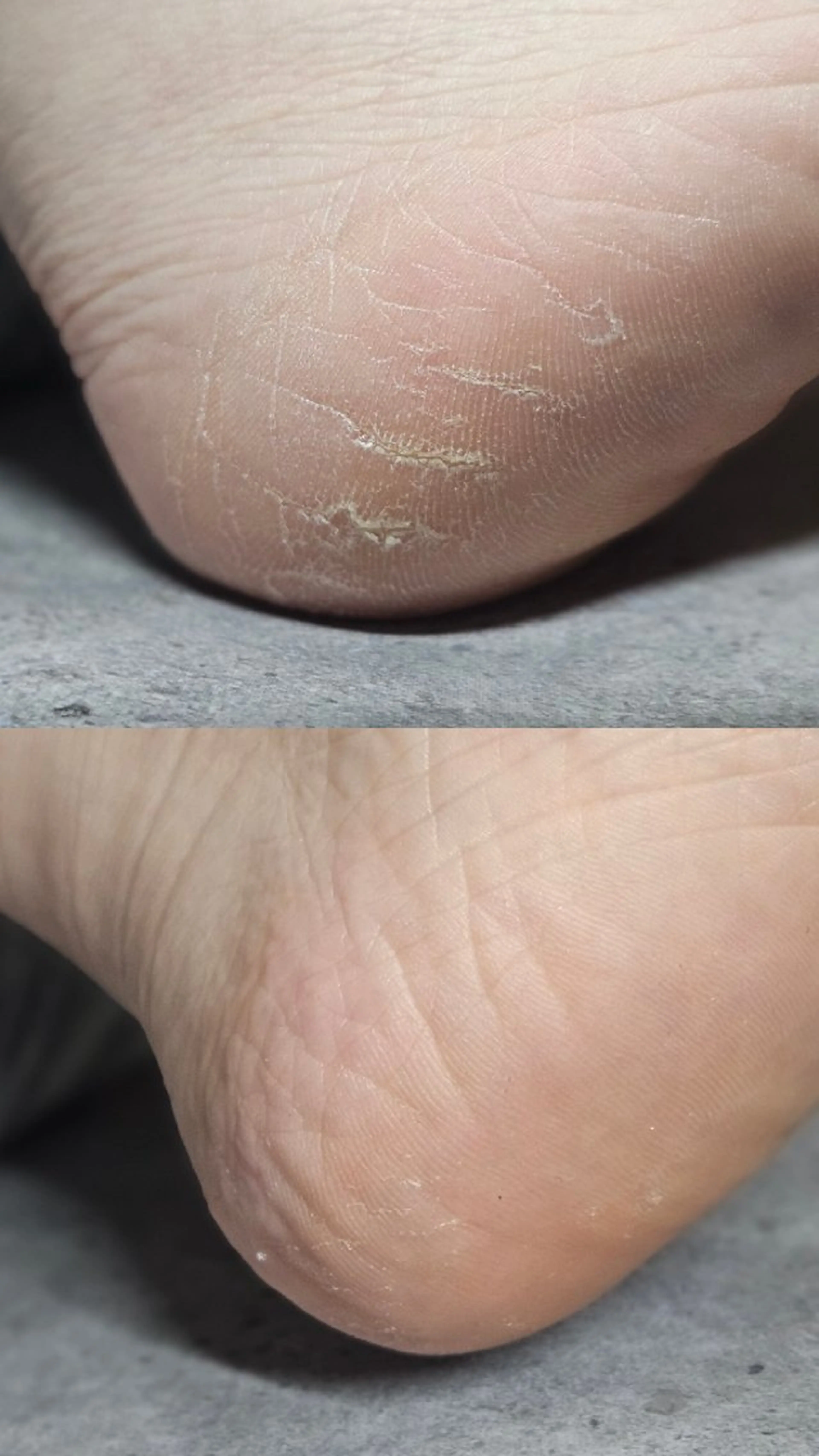 🦶足裏角質ケアモニター様募集中✨️の写真