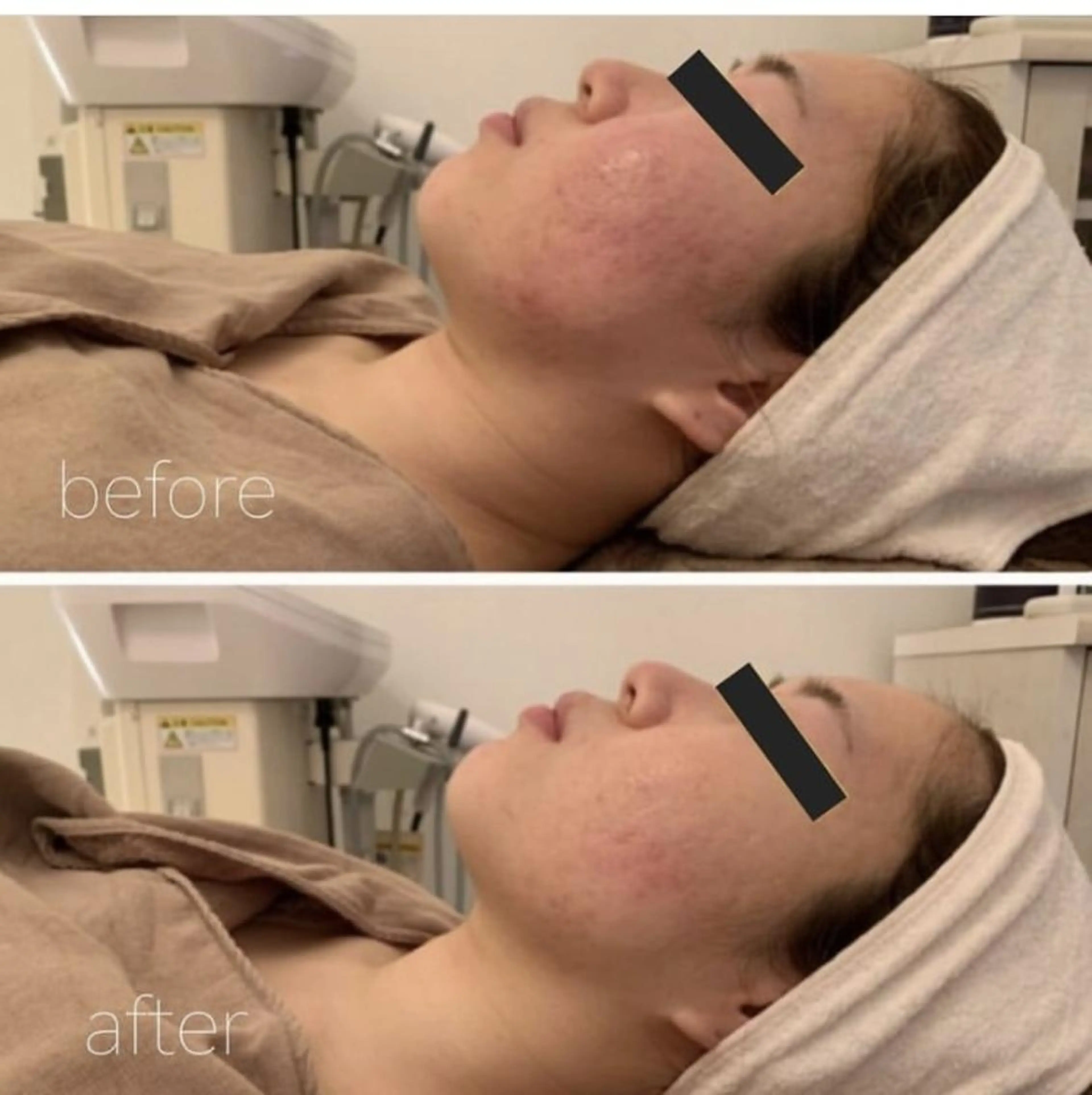 ✨美肌水光✨ アトリエリュバンのエステ・リラクイメージ