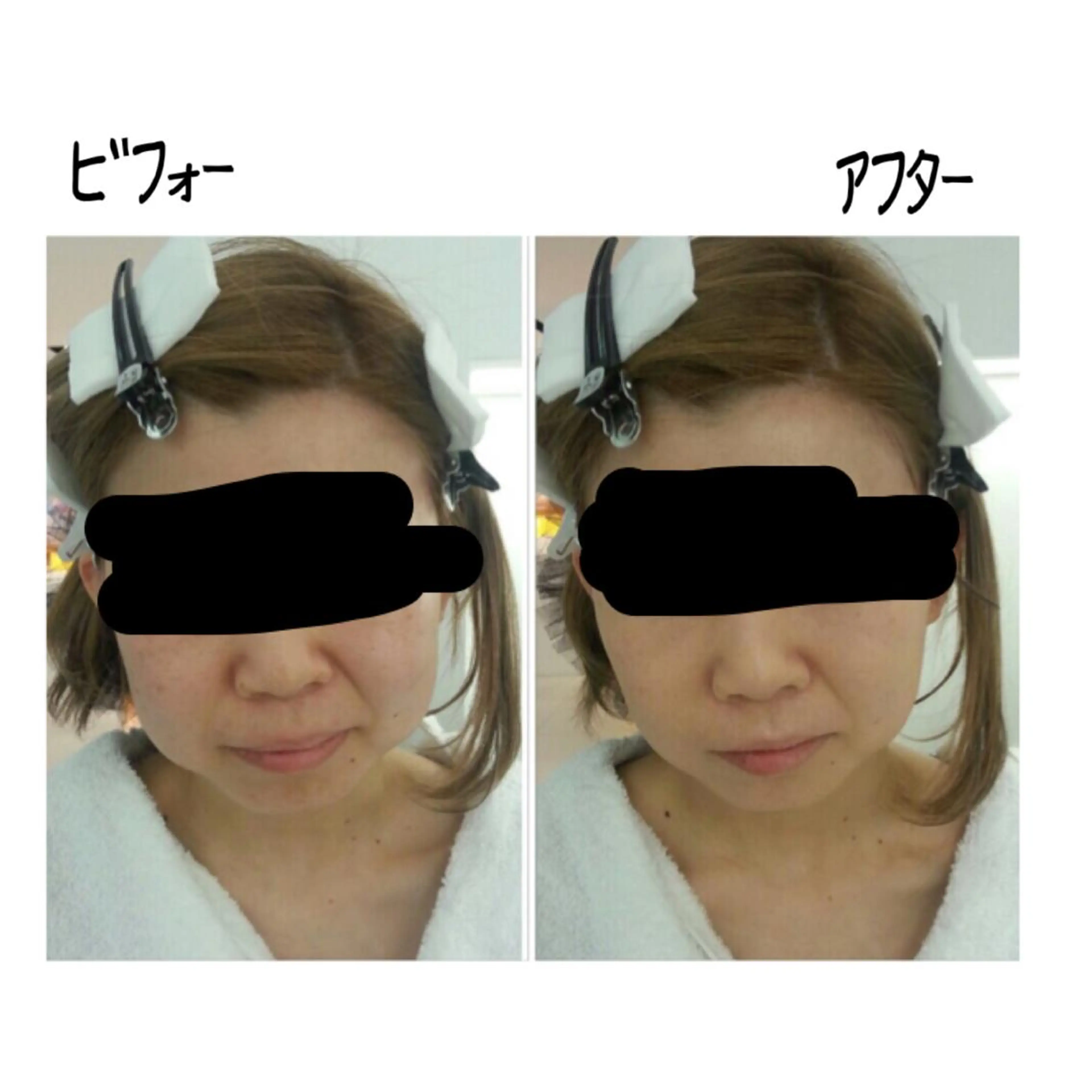 KIRICO まつぱマツエク眉毛のマツエク・マツパデザイン