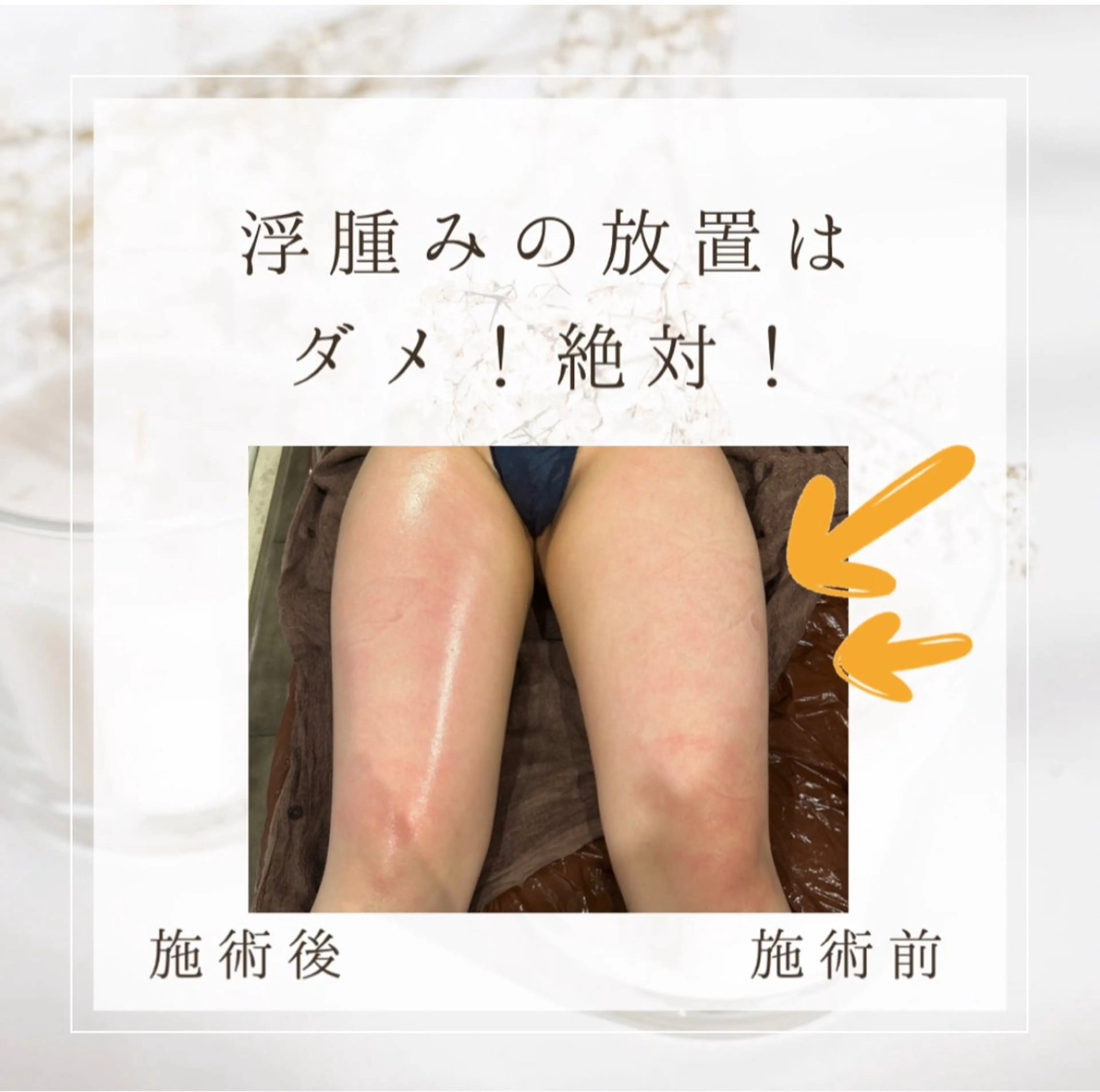 エステ Gemini MIKIのエステ・リラクイメージ