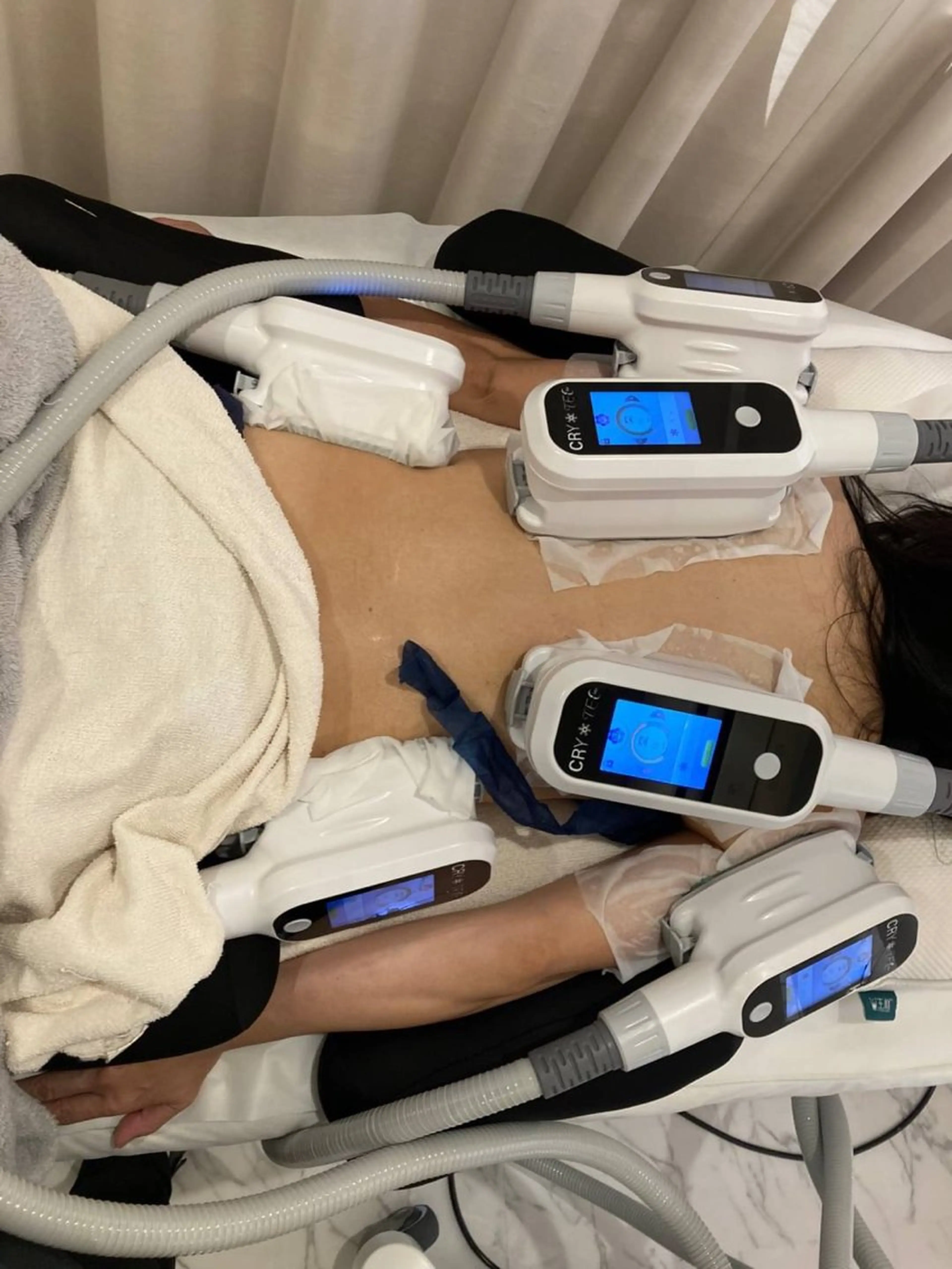 RENATA🕊 脂肪冷却専門店六本木のエステ・リラクイメージ