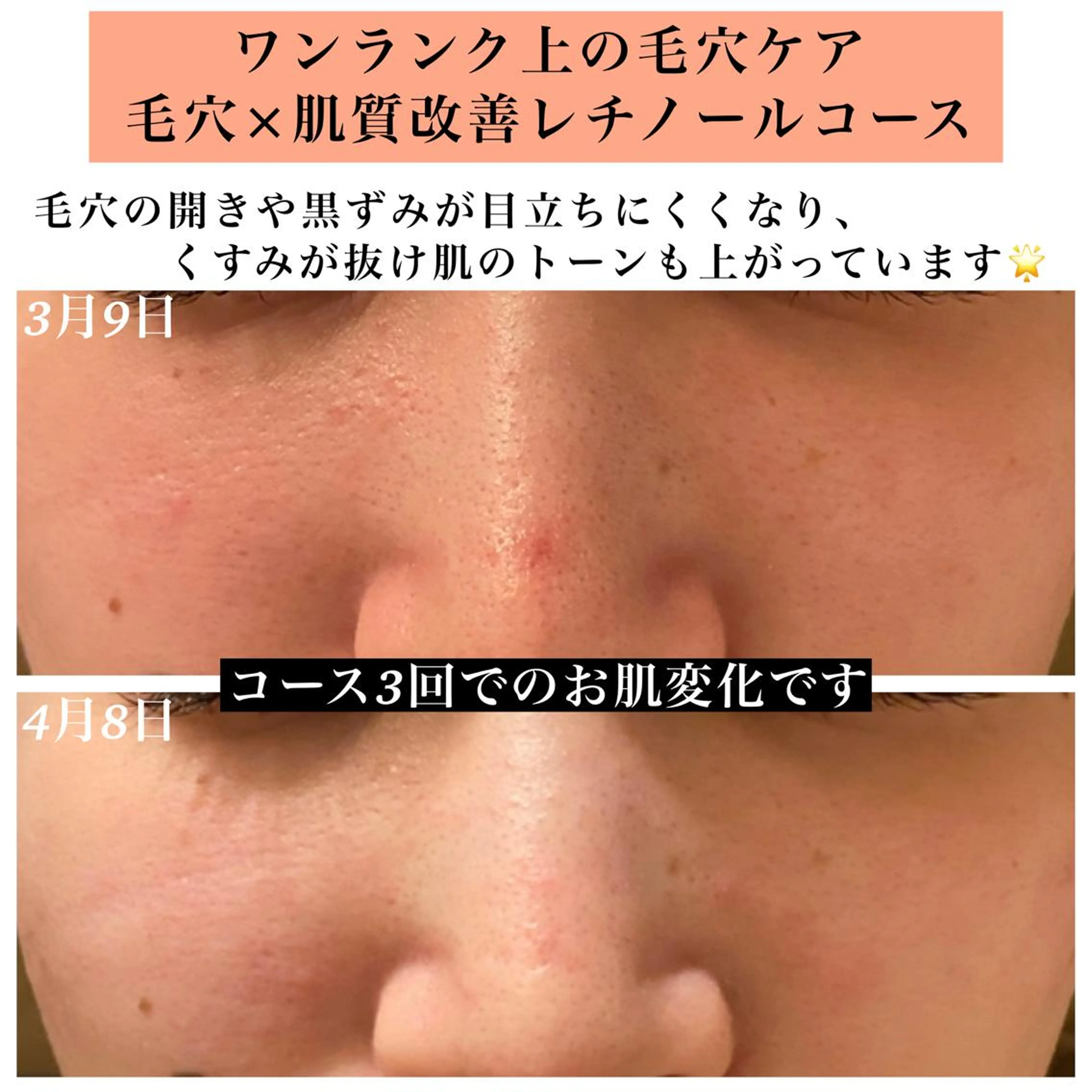 エステ リラク Bellesthe （ベルエステ）のエステ・リラクイメージ