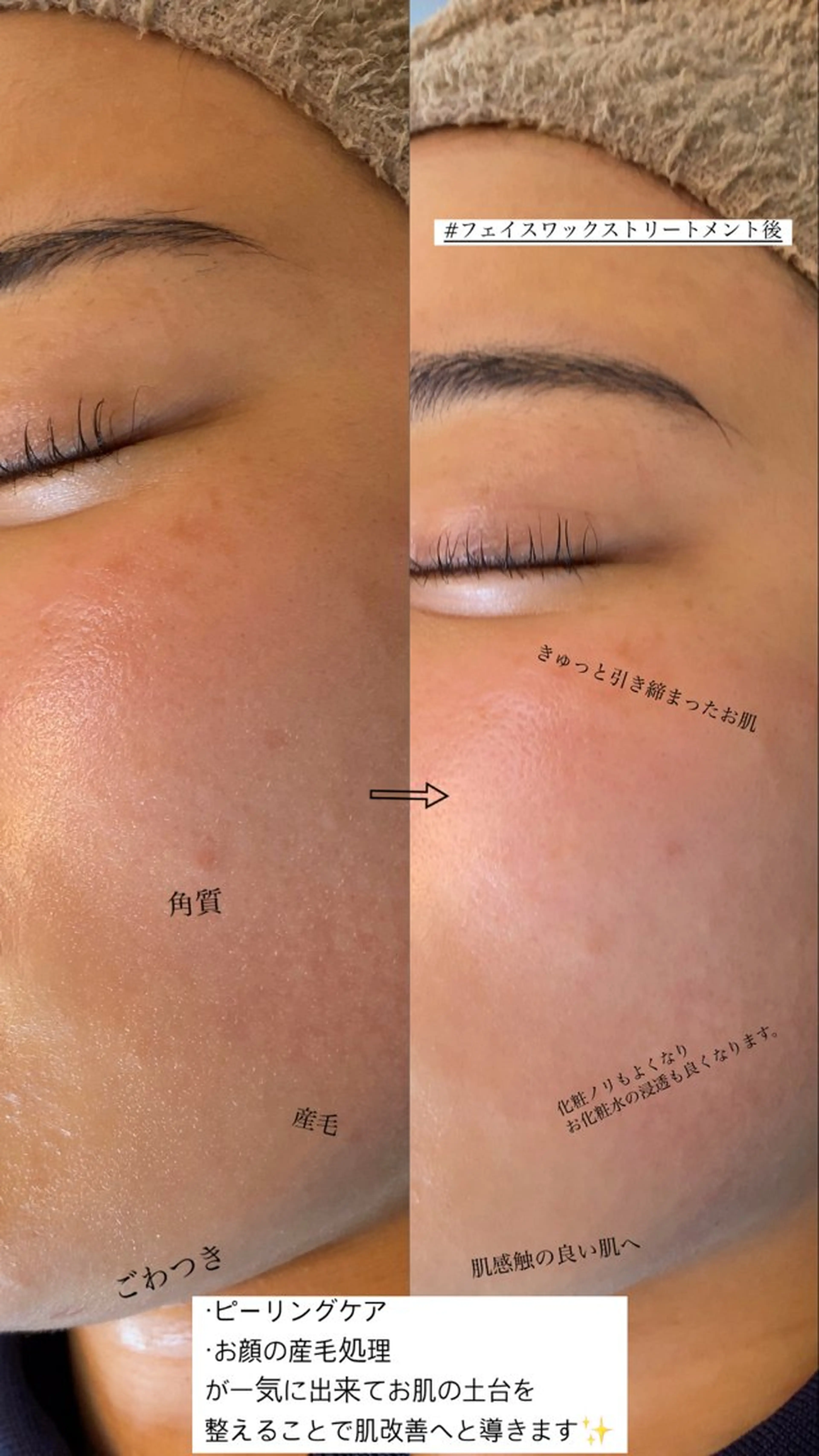 エステ デコパーツが得意♪ ネイル/眉毛/エステの眉毛・アイブロウイメージ