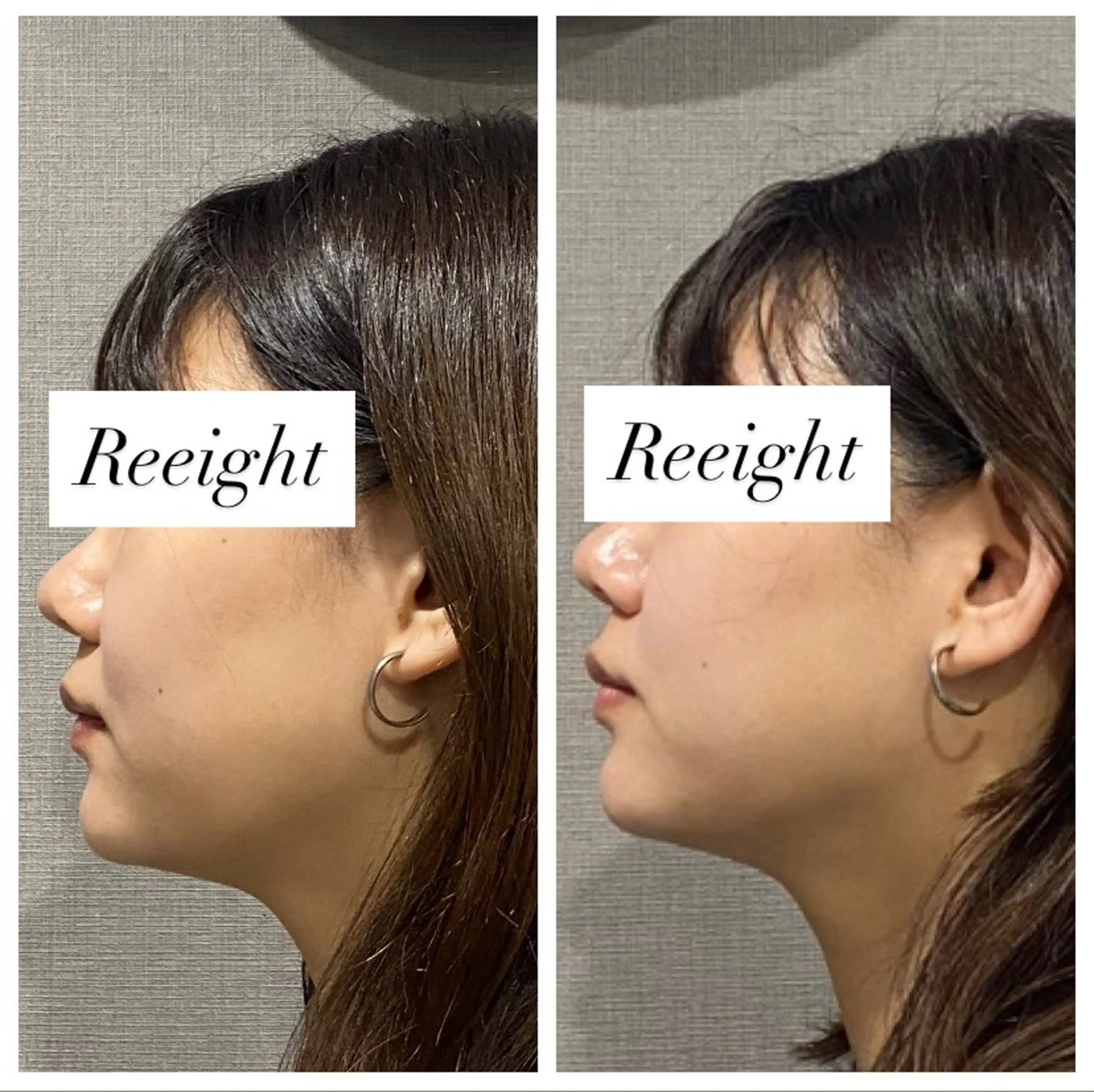 エステ 肌質改善専門 ハーブ /毛穴洗浄 リエイトのエステ・リラクイメージ