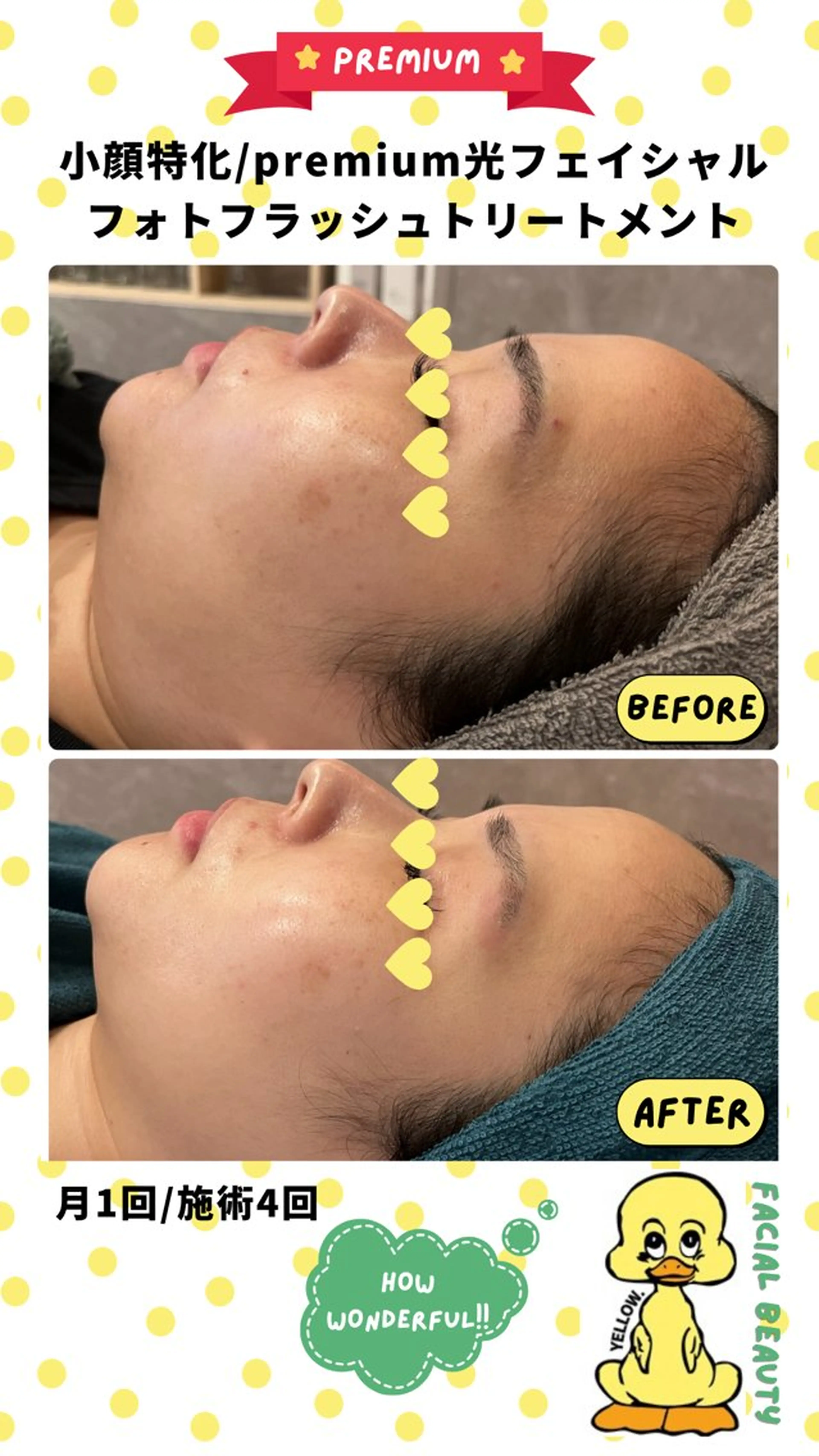 エステ blue.【都度払い脱毛&フェイシャルサロン】所属・blue.💙【 脱毛&フェイシャル】のエステ・リラクイメージ