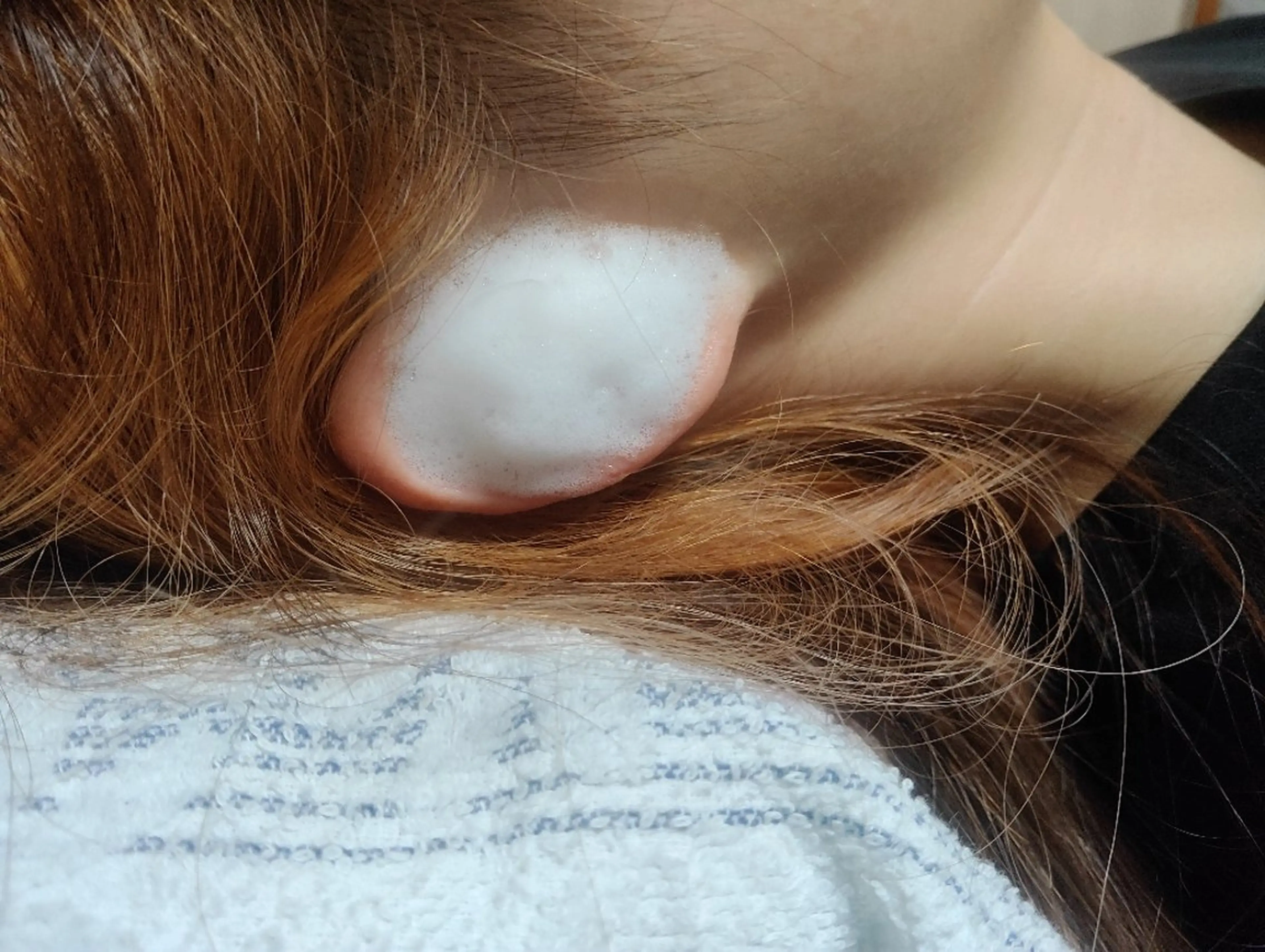 【３０歳以下限定】耳掃除のモデル募集の写真