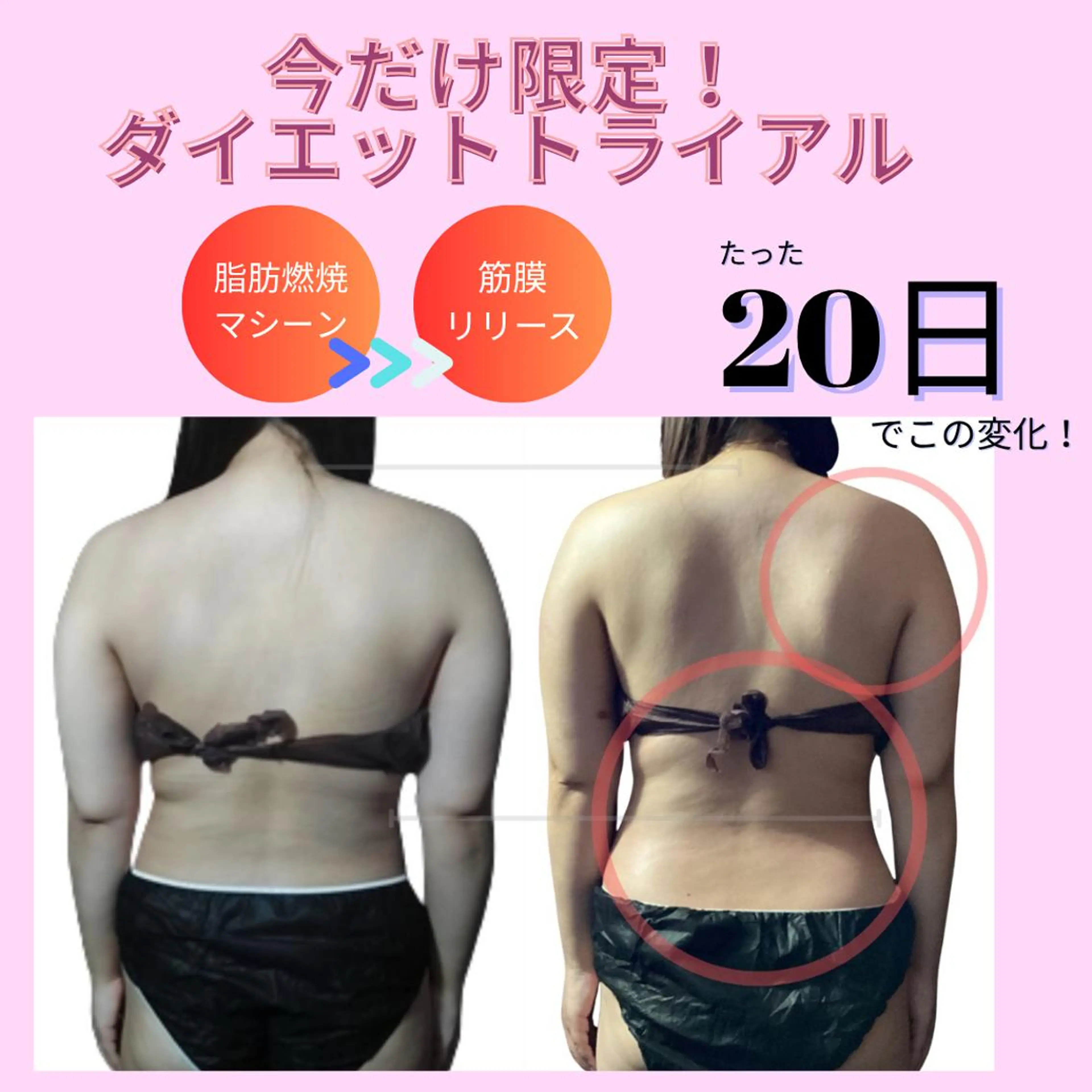 🌸2か月集中通い放題🌸ダイエットトライアル/残り2名❣の写真