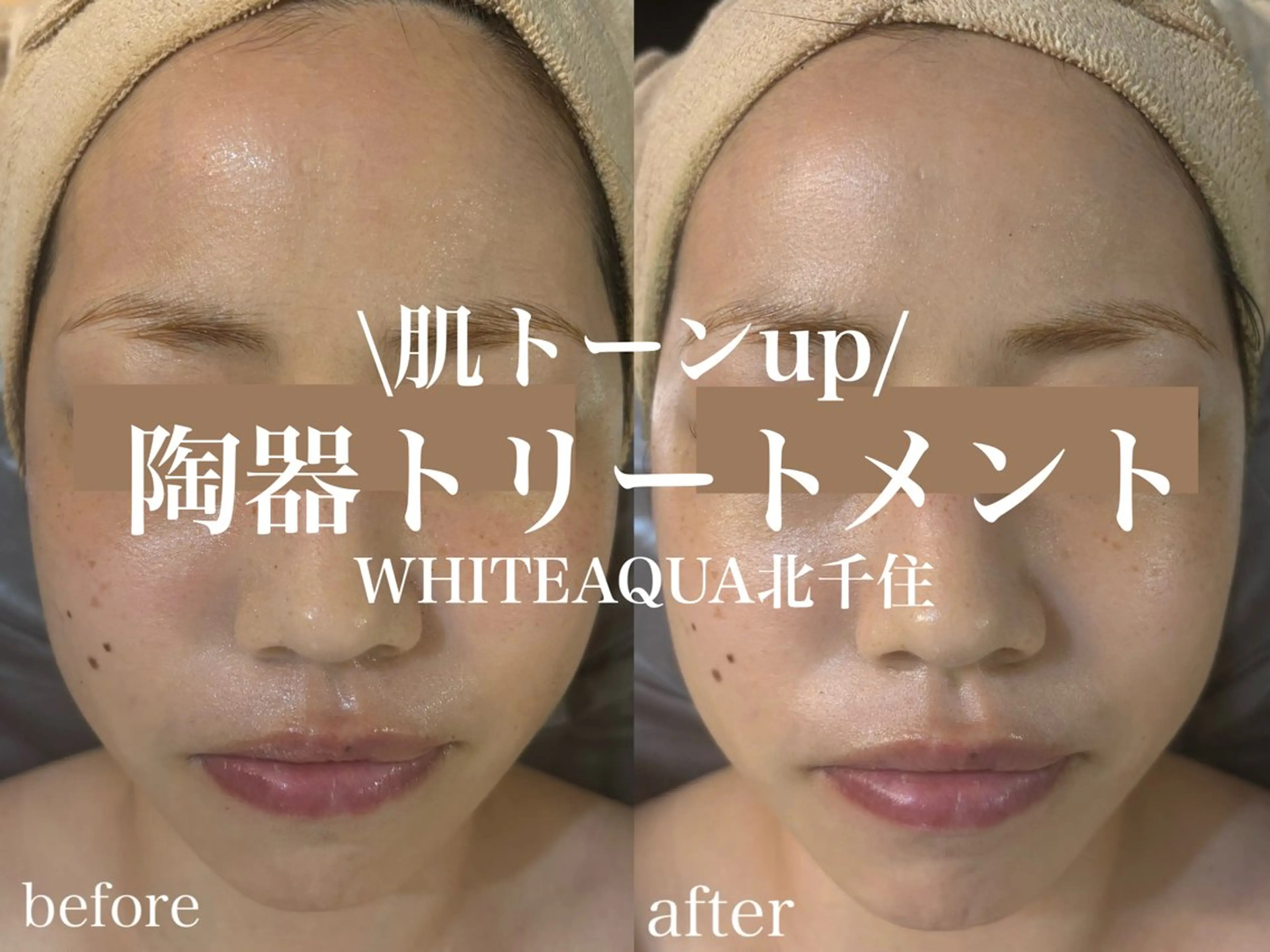 エステ WHITE AQUA 北千住店のエステ・リラクイメージ